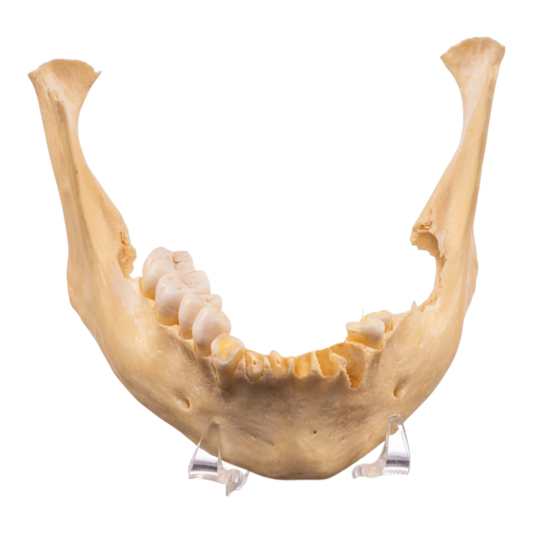 Real Human Mandible - Set of 3 - Image 2
