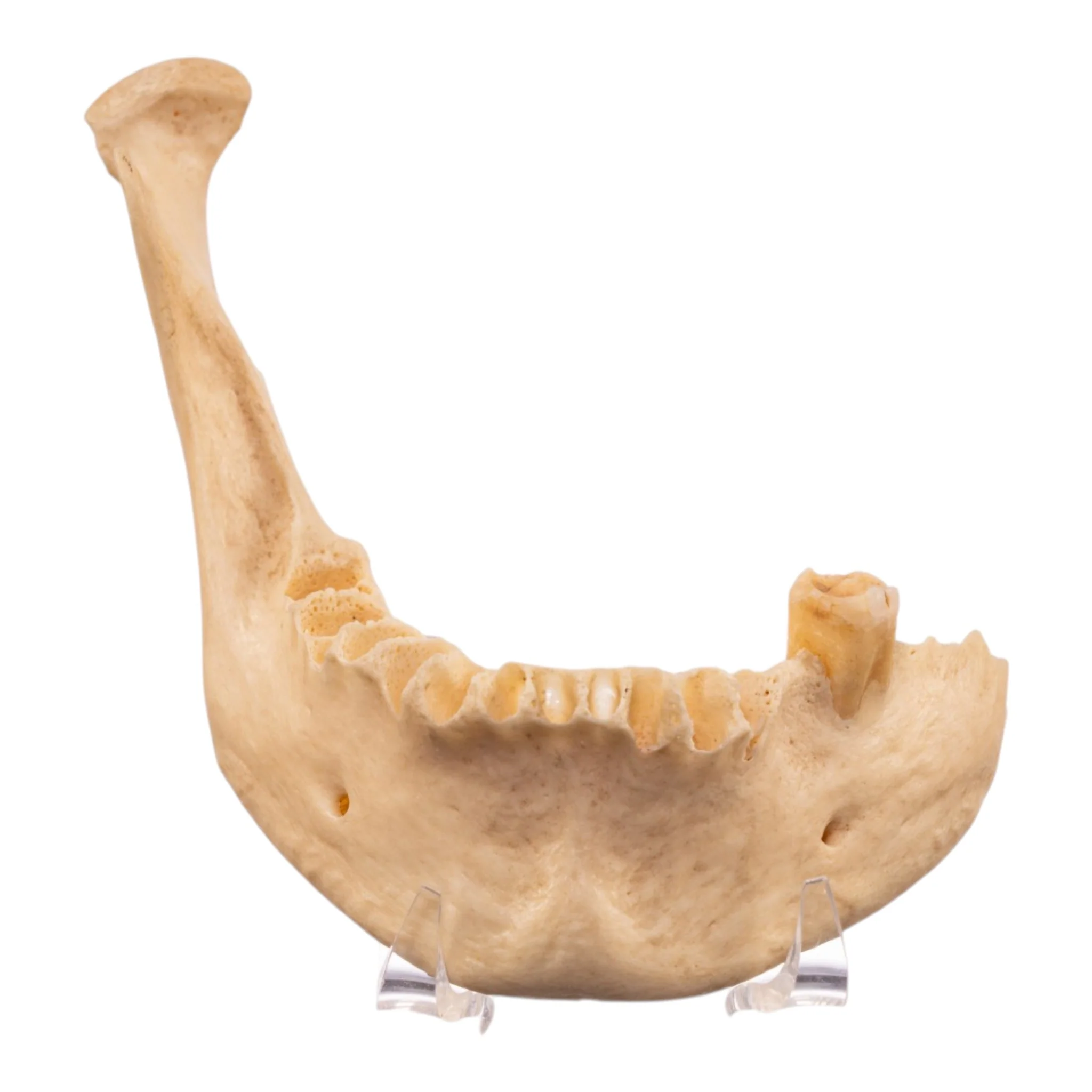 Real Human Mandible - Set of 3 - Image 3