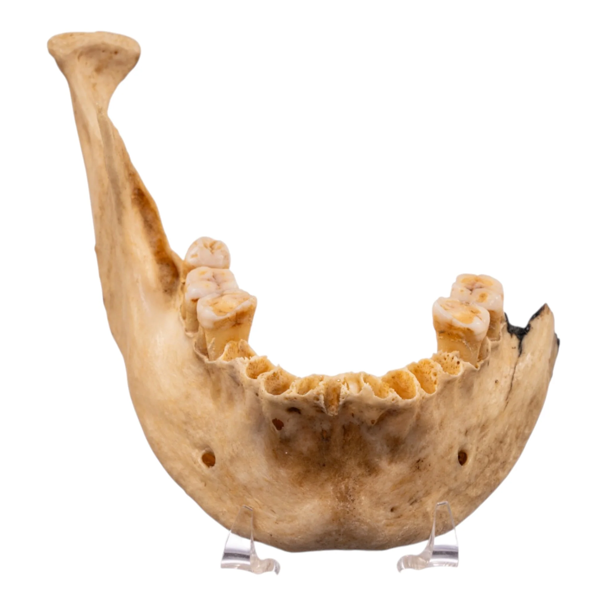 Real Human Mandible - Set of 3 - Image 4