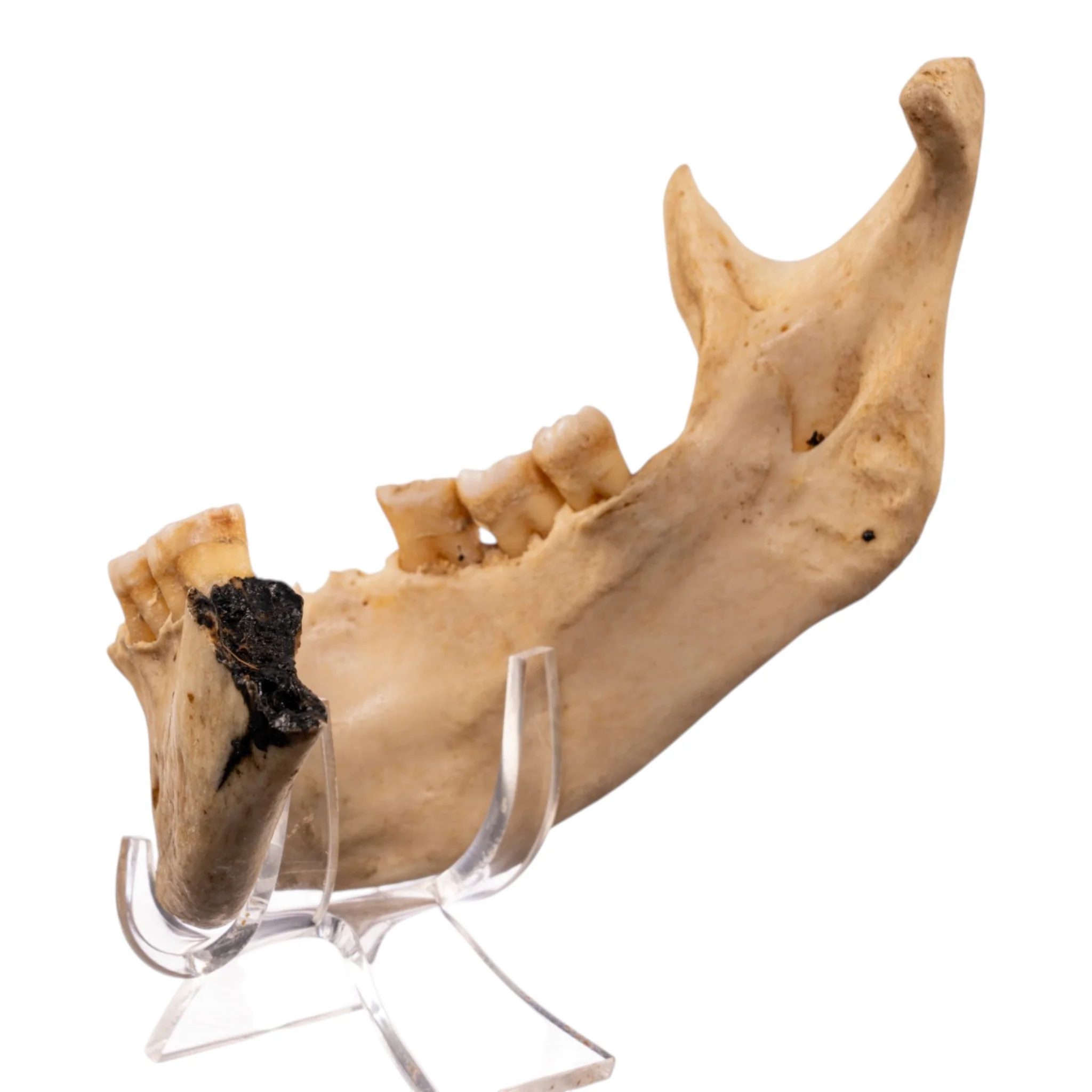 Real Human Mandible - Set of 3 - Image 5