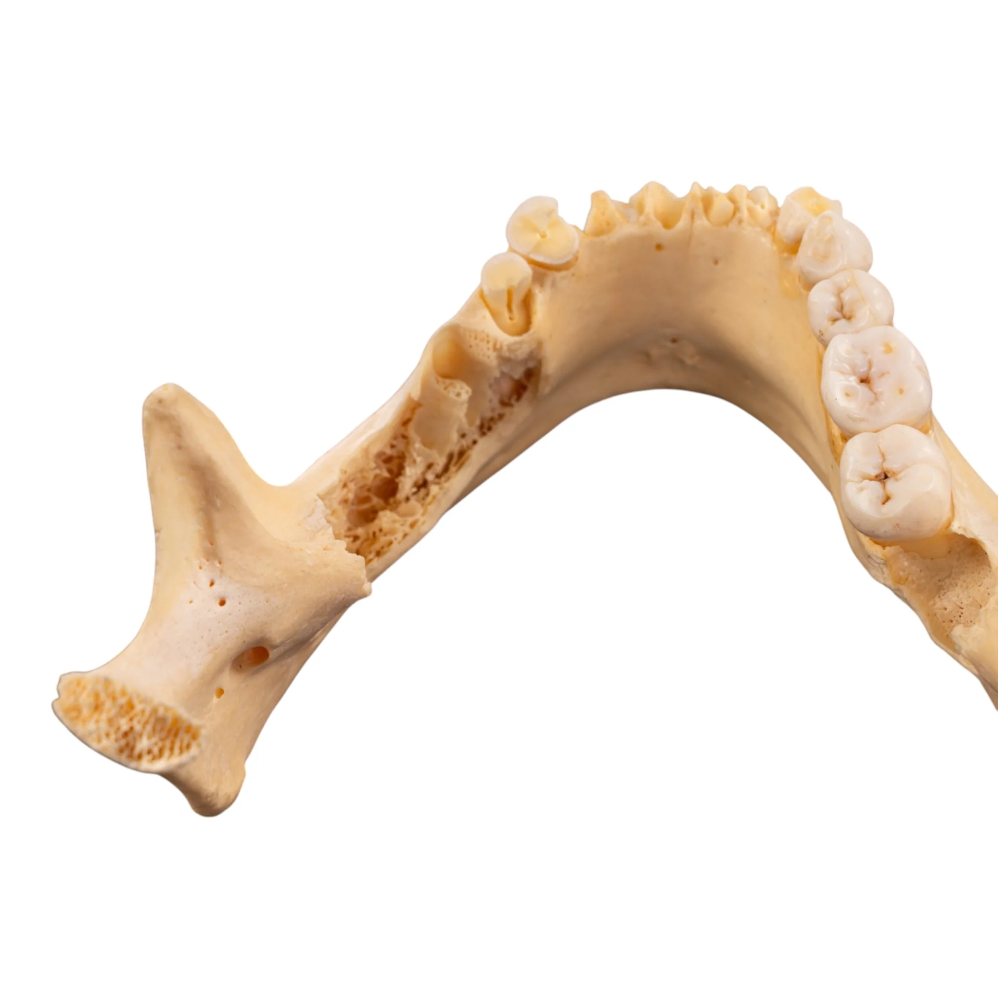 Real Human Mandible - Set of 3 - Image 6