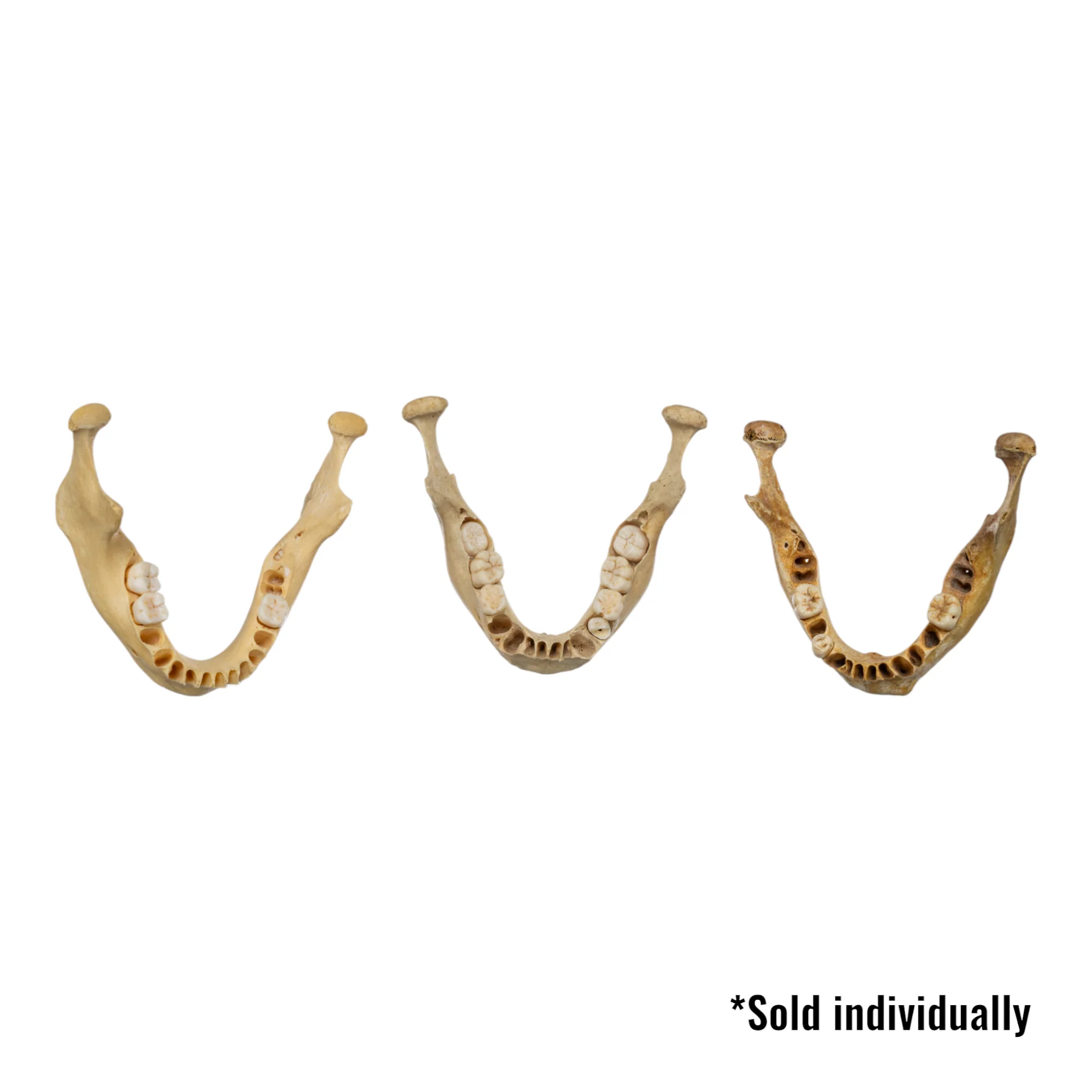 Real Human Mandible - Young (Single) - Image 3