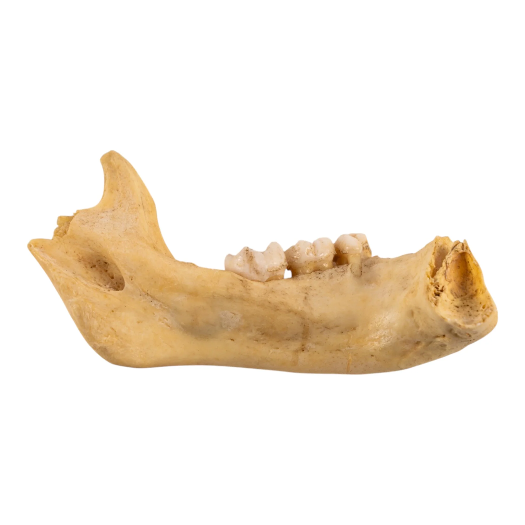 Real Human Child Partial Mandible - Image 2