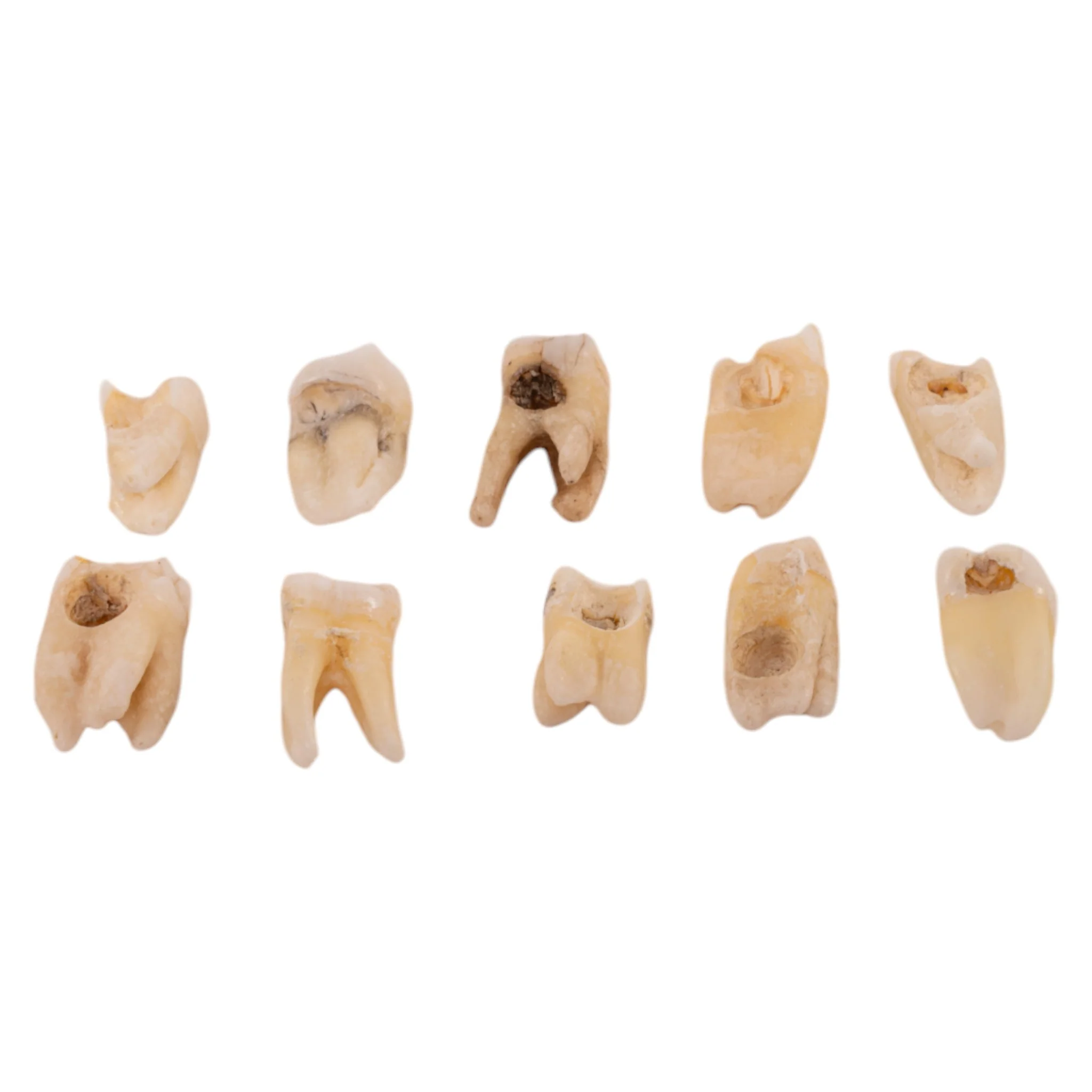 Real Human Molar - Image 2