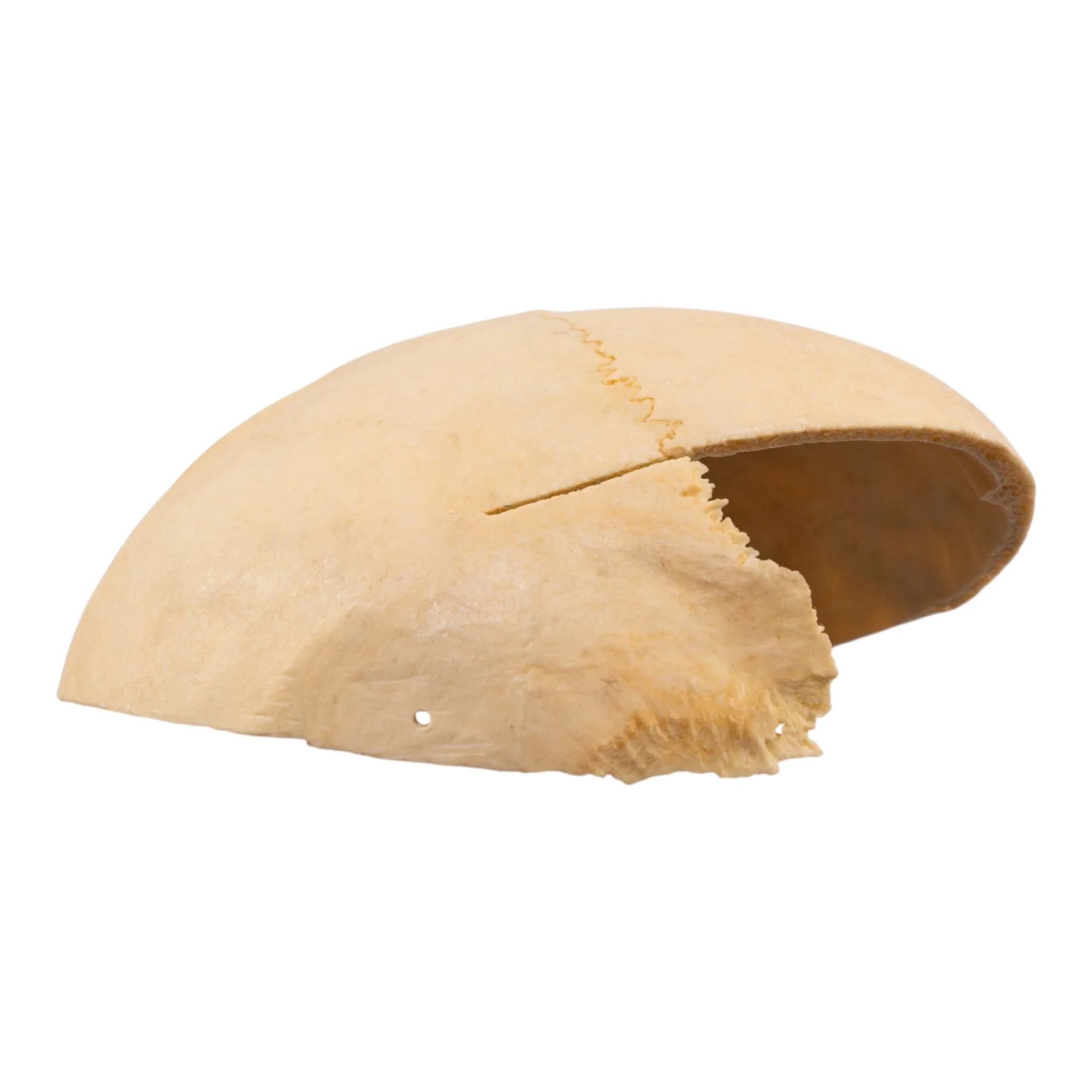 Real Human Partial Calvaria - Image 2
