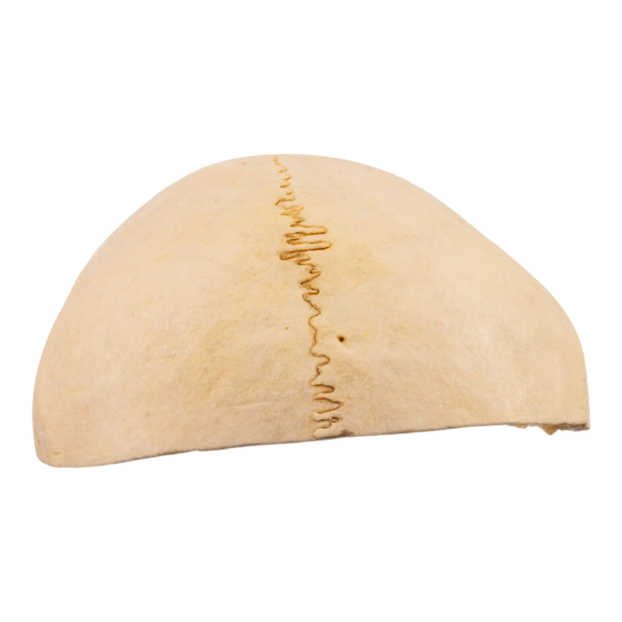 Real Human Partial Calvaria - Image 3