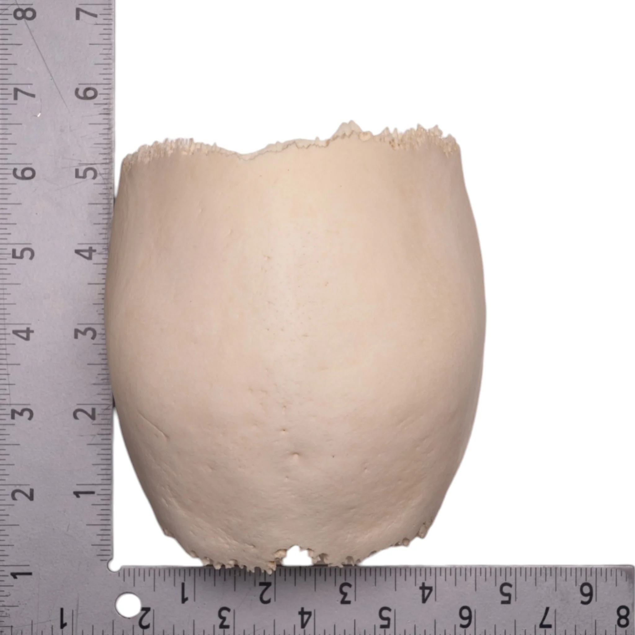Real Human Partial Cranial Vault - Image 4