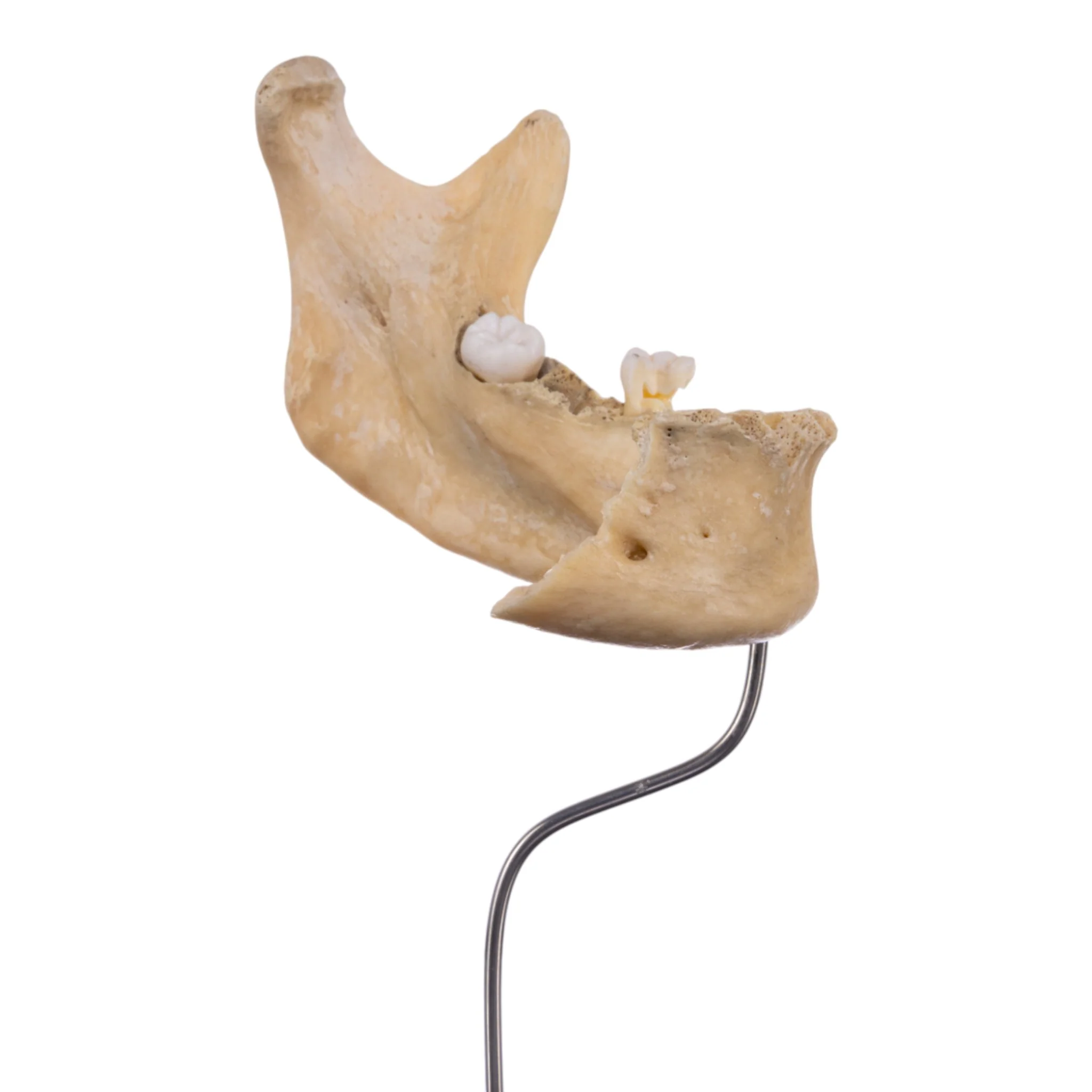 Real Human Partial Mandible On Stand - Image 2