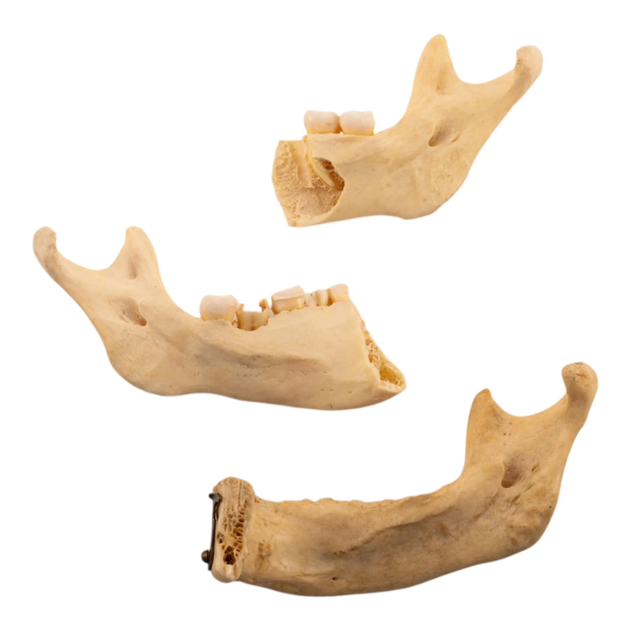 Real Human Partial Mandible - Set of 3 - Image 2