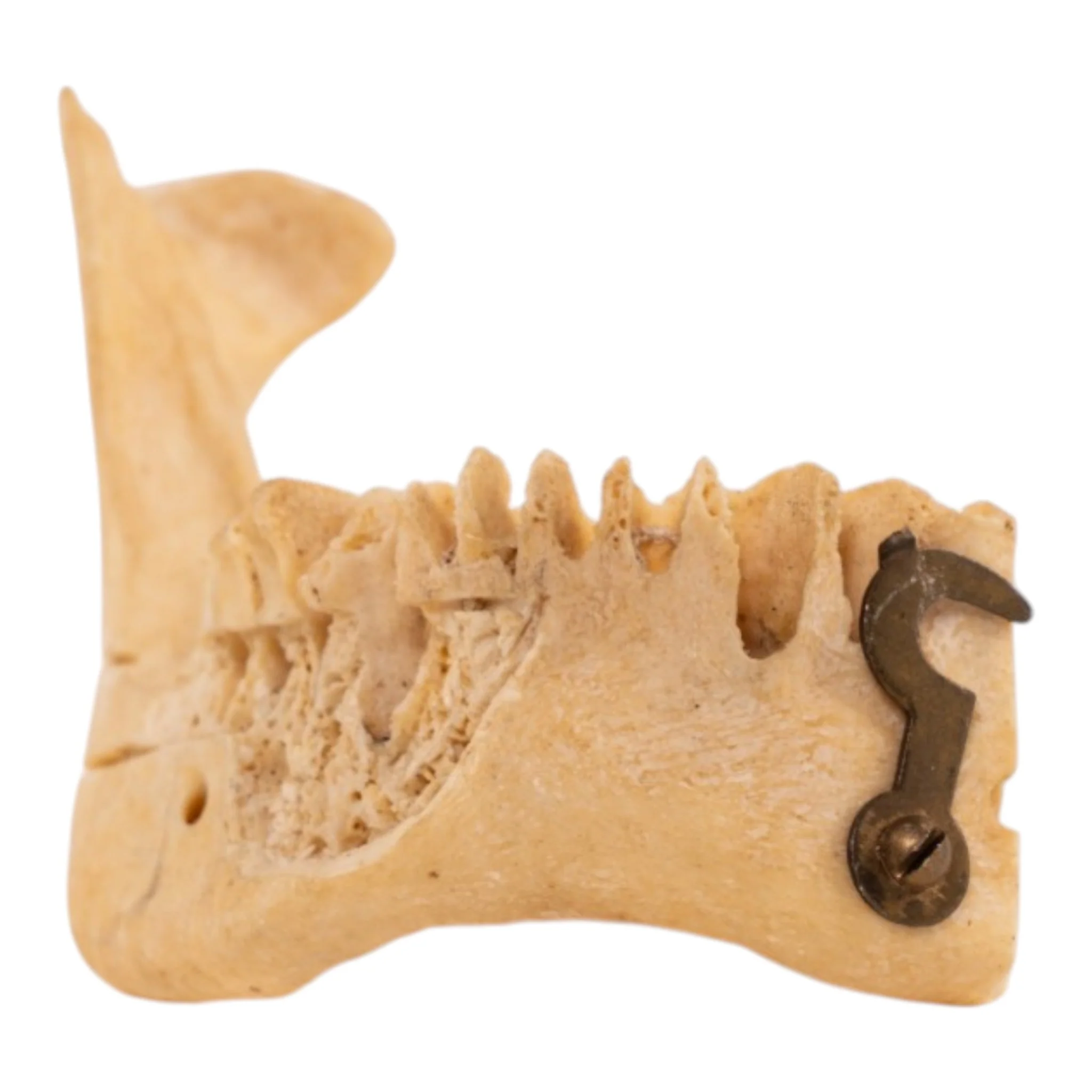 Real Human Partial Mandible - Set of 3 - Image 3
