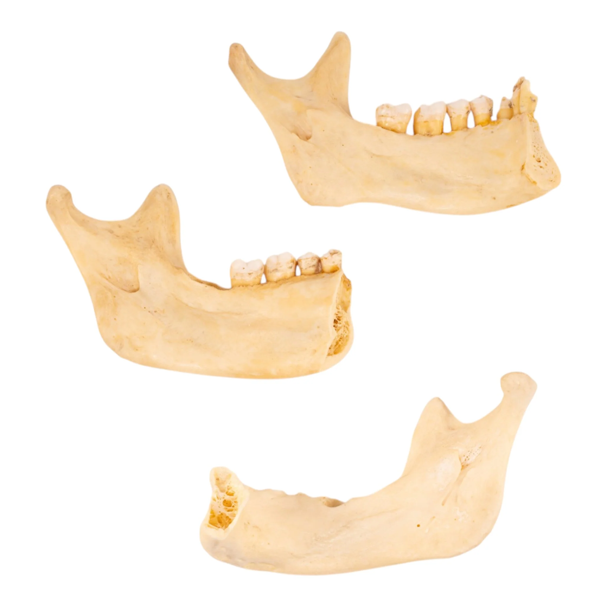 Real Human Partial Mandible - Set of 3 - Image 2