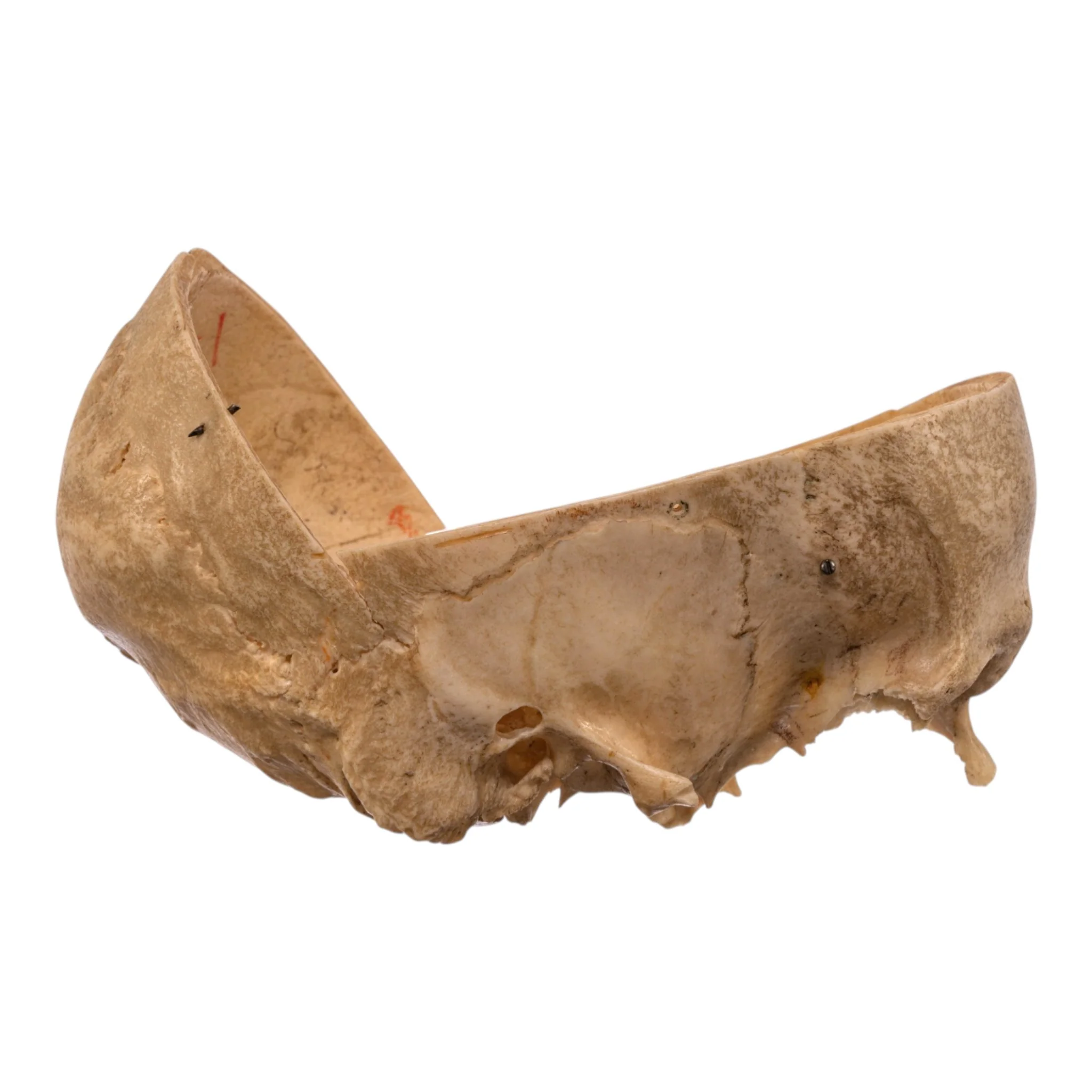 Real Human Partial Skull - Image 2