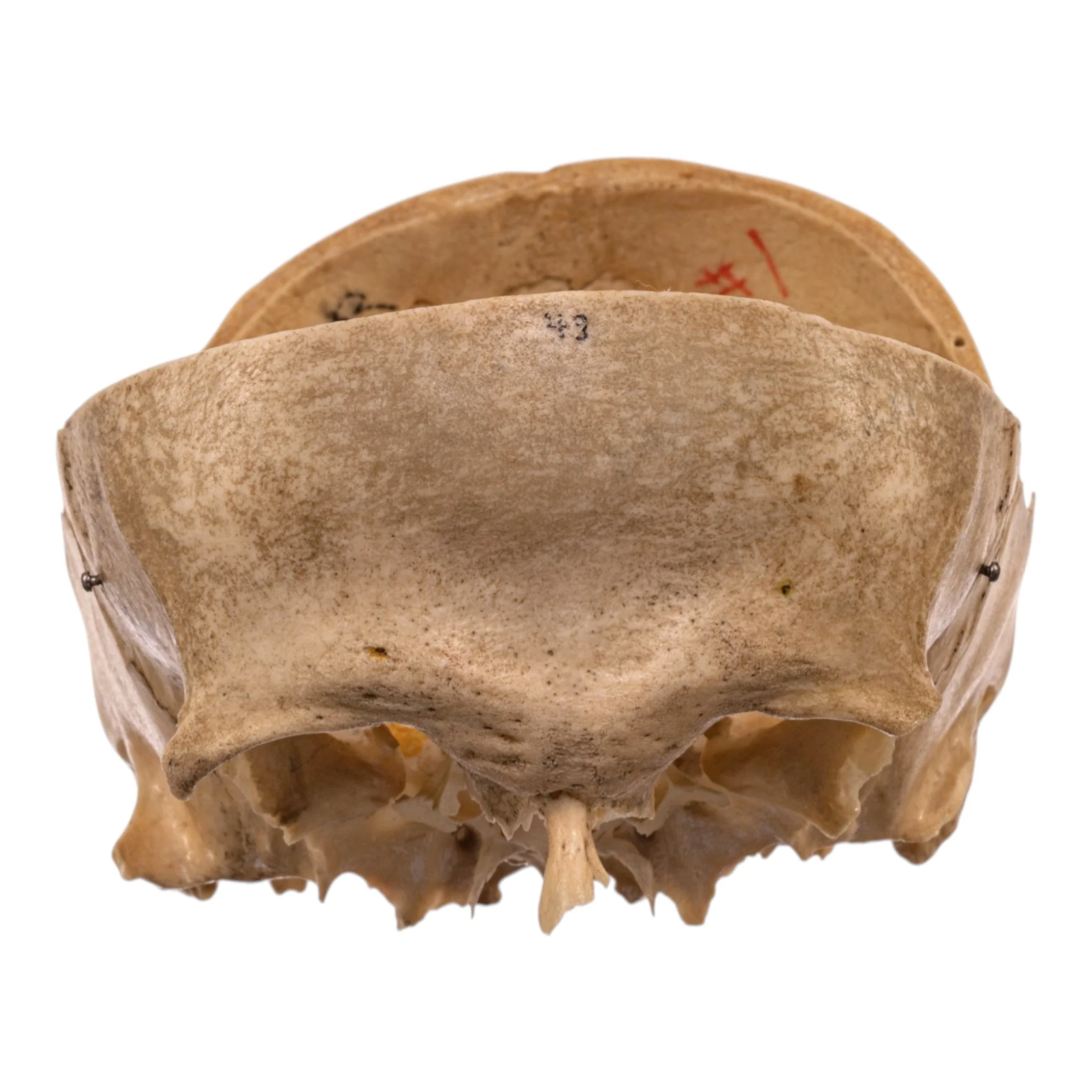 Real Human Partial Skull - Image 3