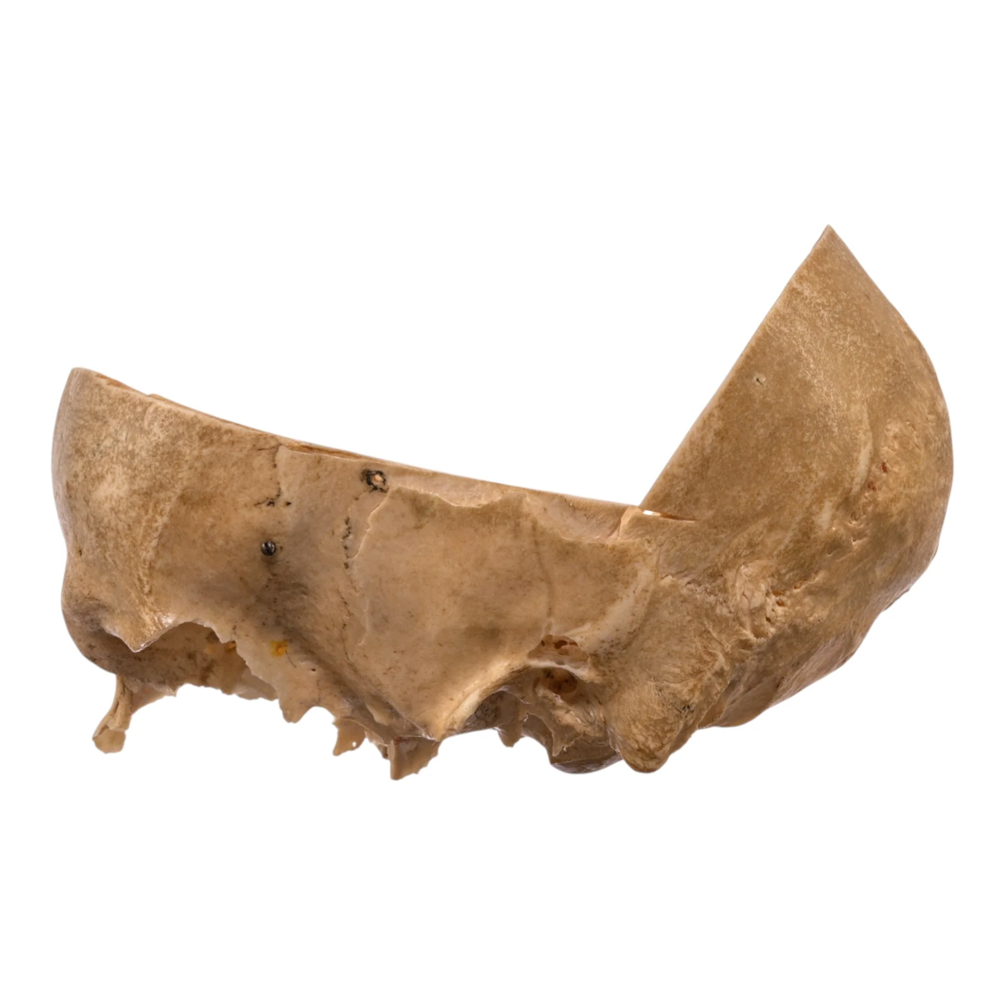 Real Human Partial Skull - Image 4