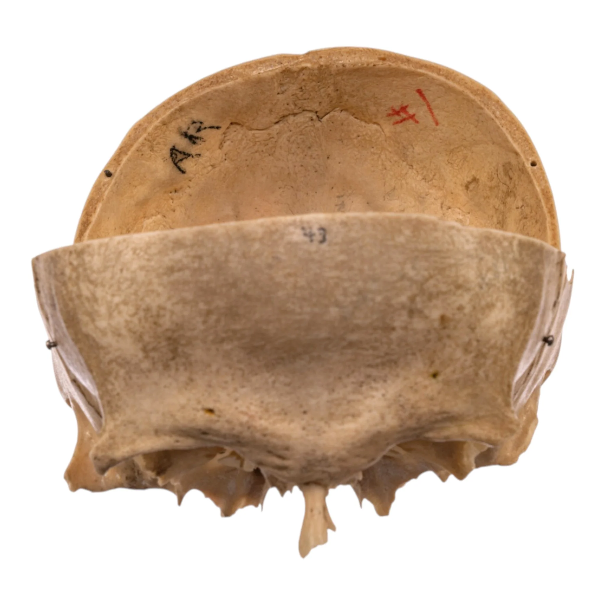 Real Human Partial Skull - Image 5