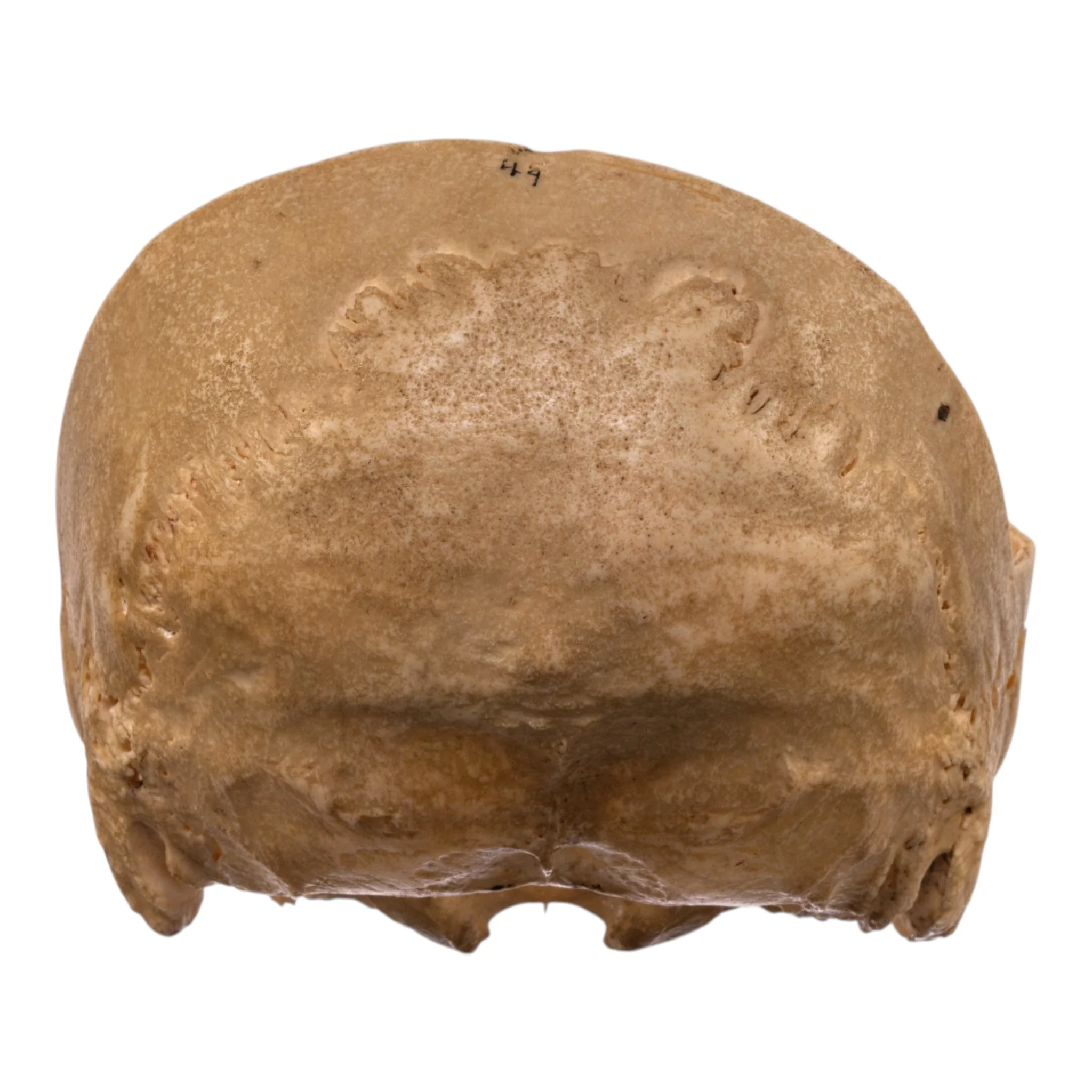 Real Human Partial Skull - Image 6