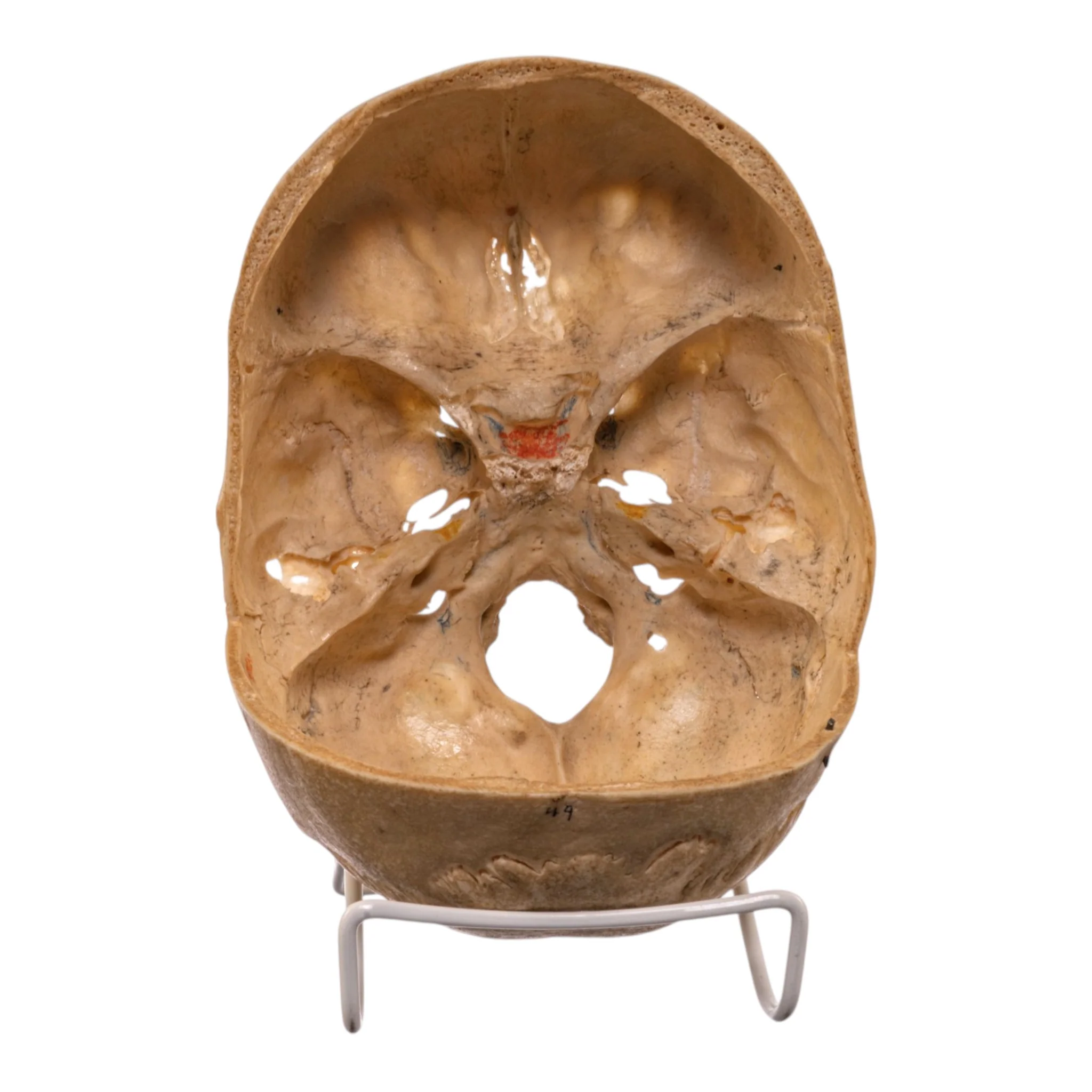 Real Human Partial Skull - Image 7