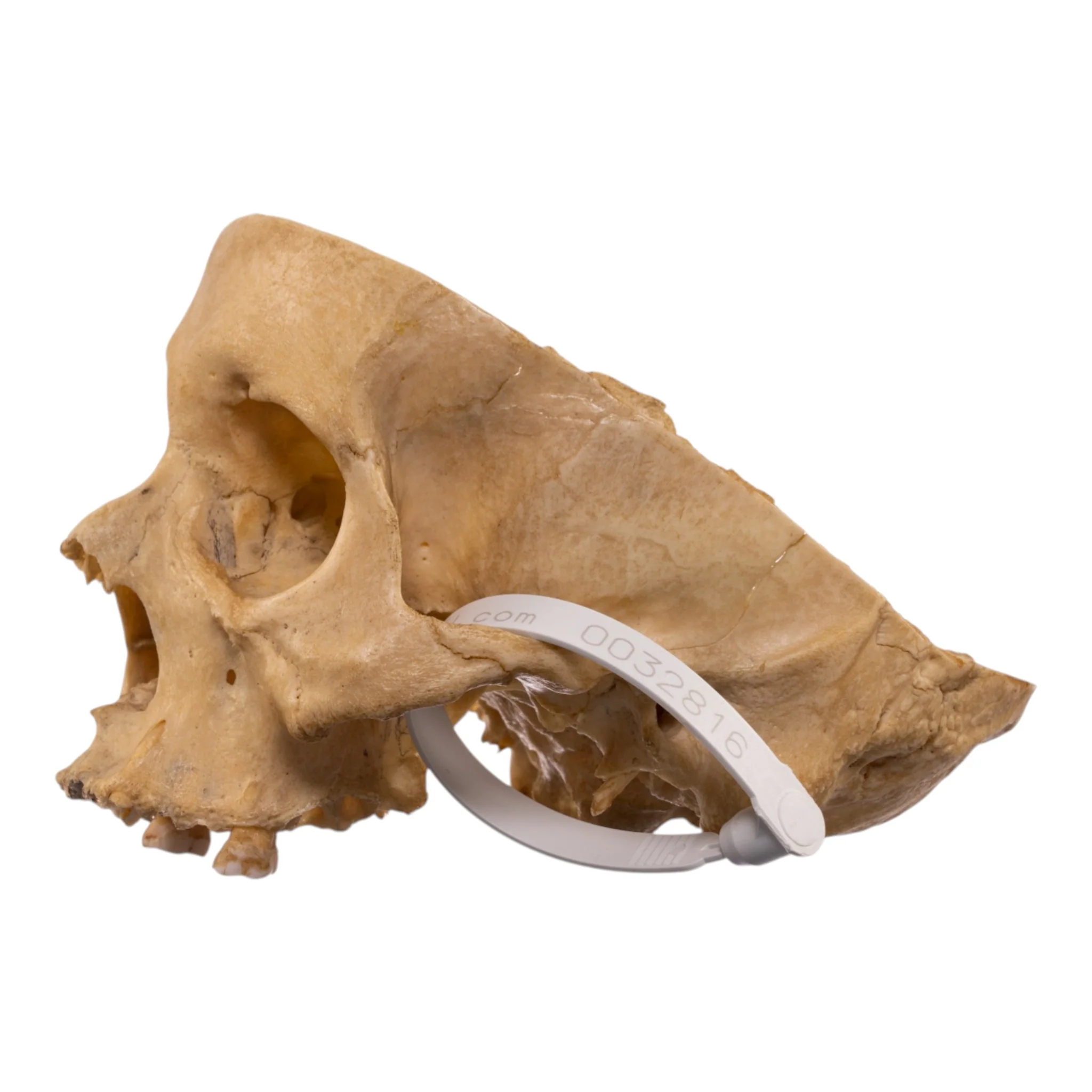Real Human Partial Skull - Image 4