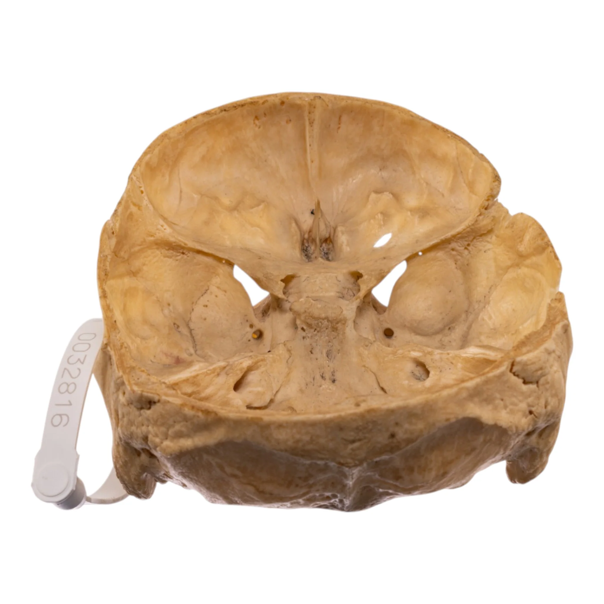 Real Human Partial Skull - Image 5