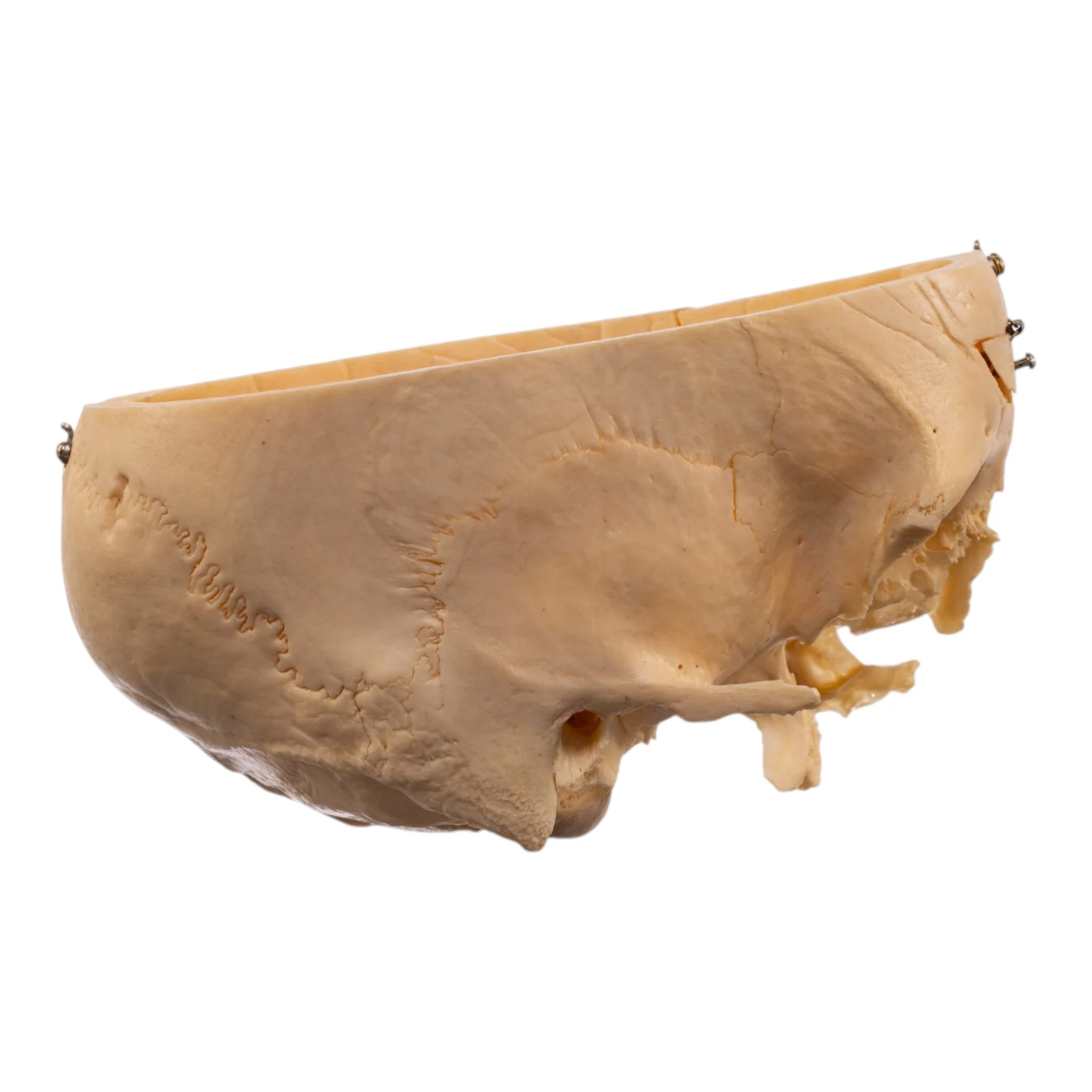Real Human Partial Skull - Dissected - Image 2