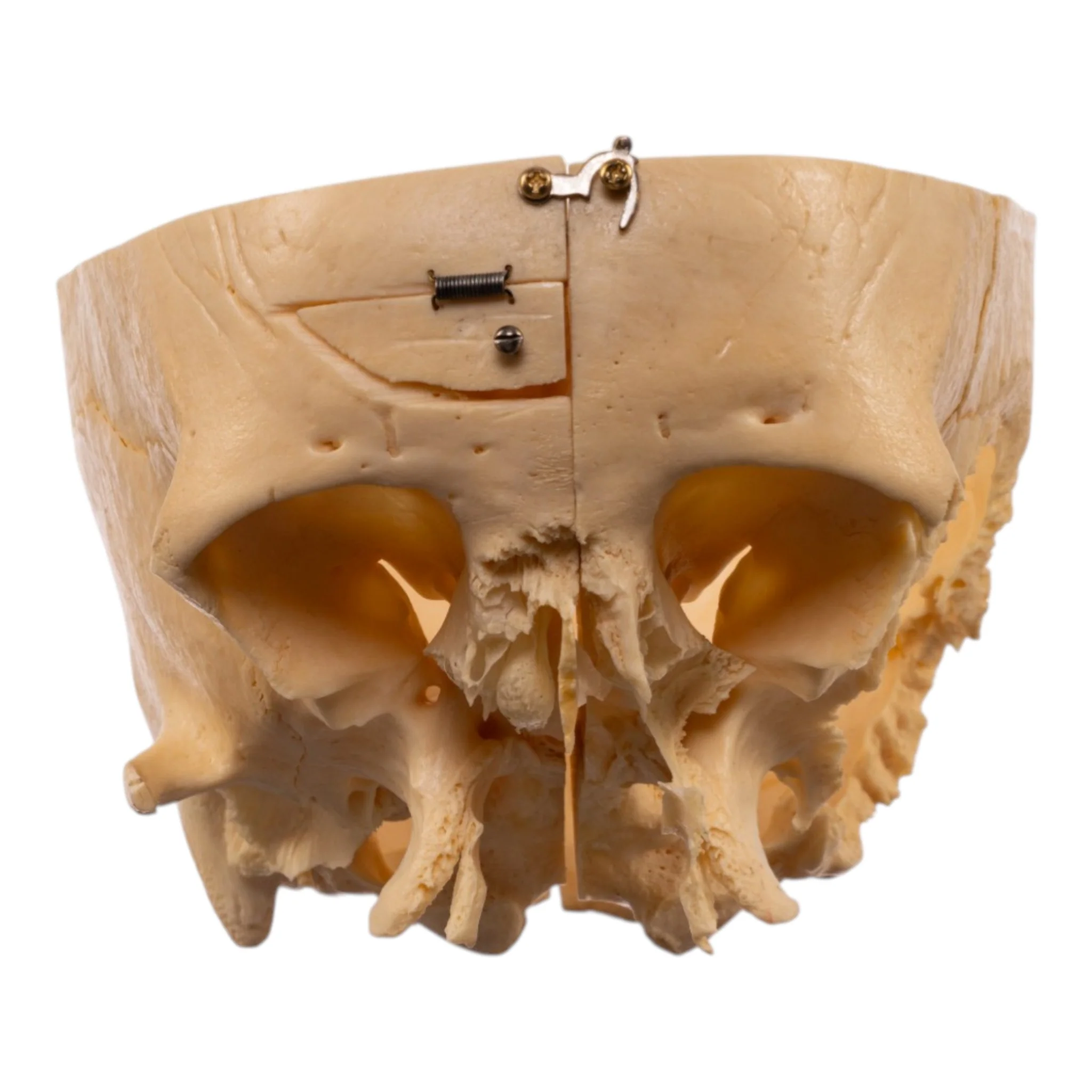 Real Human Partial Skull - Dissected - Image 3