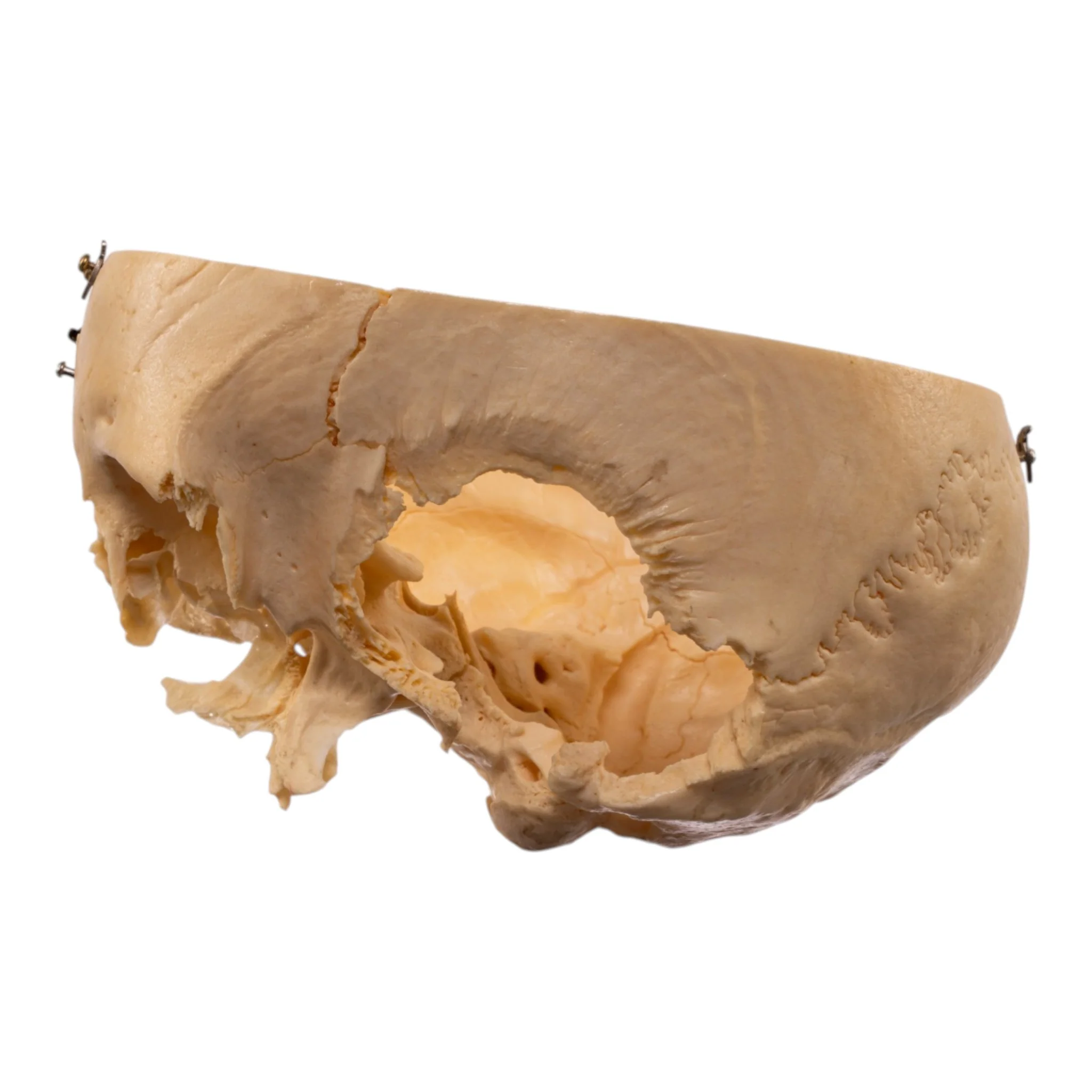 Real Human Partial Skull - Dissected - Image 4