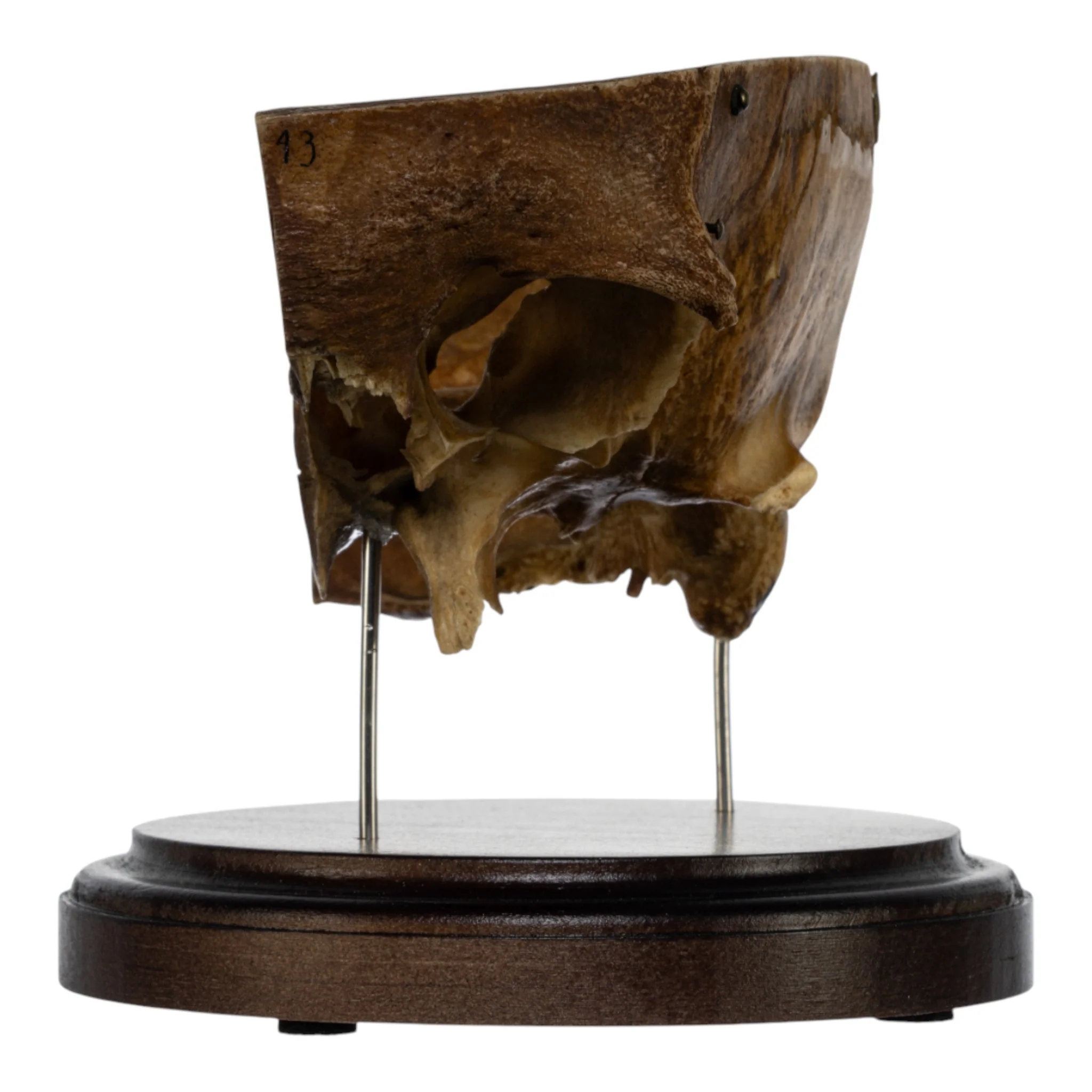 Real Human Partial Skull on Stand - Image 2