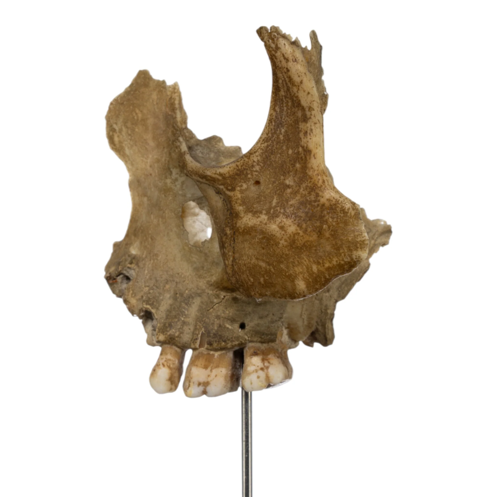 Real Human Partial Skull on Stand - Image 2