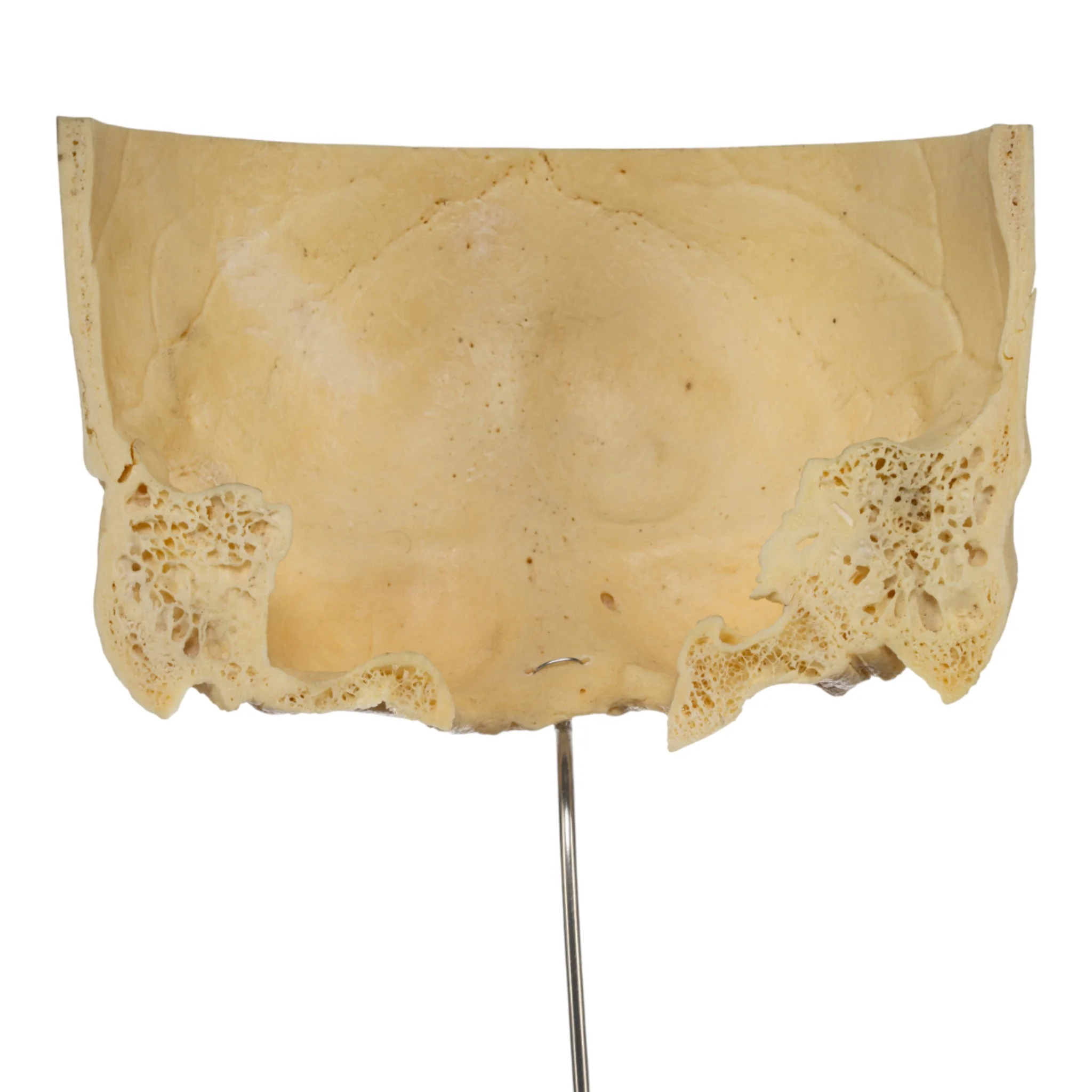Real Human Partial Skull on Stand - Image 3