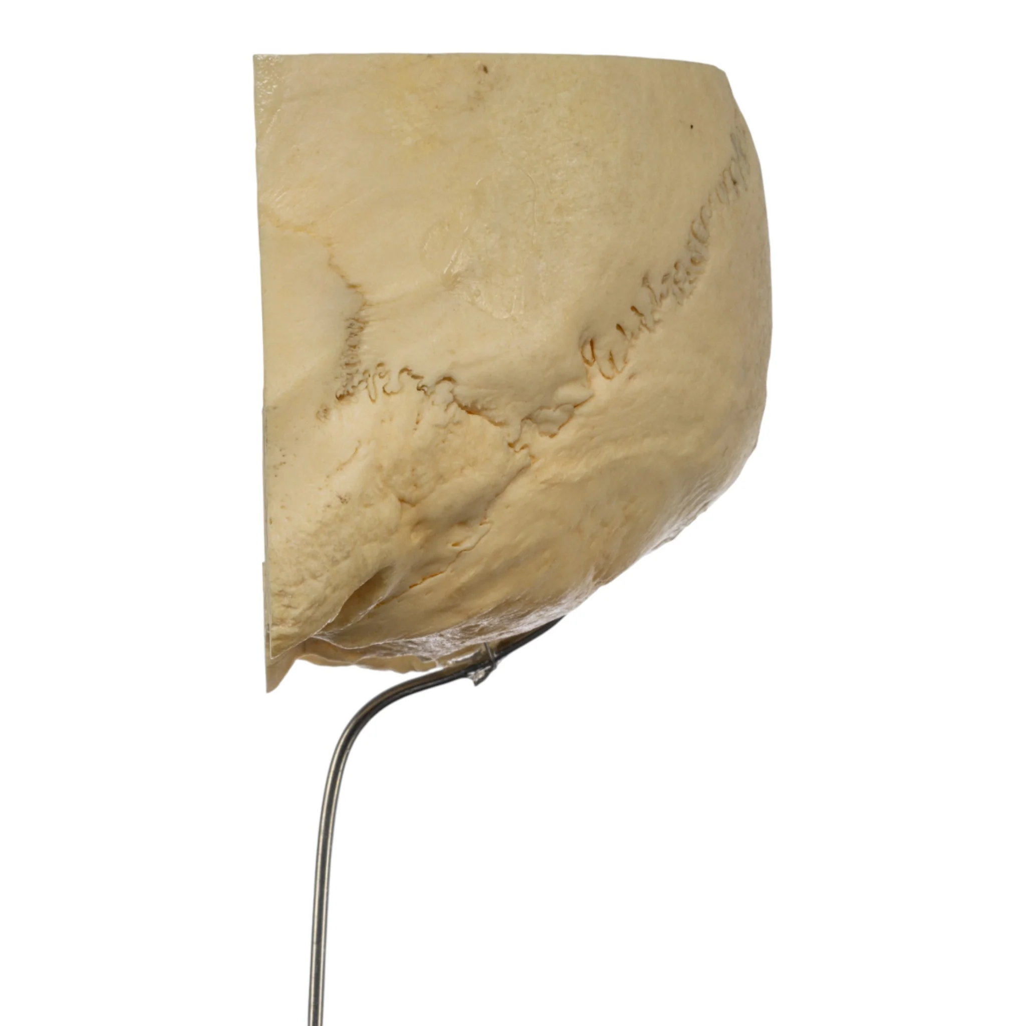 Real Human Partial Skull on Stand - Image 4