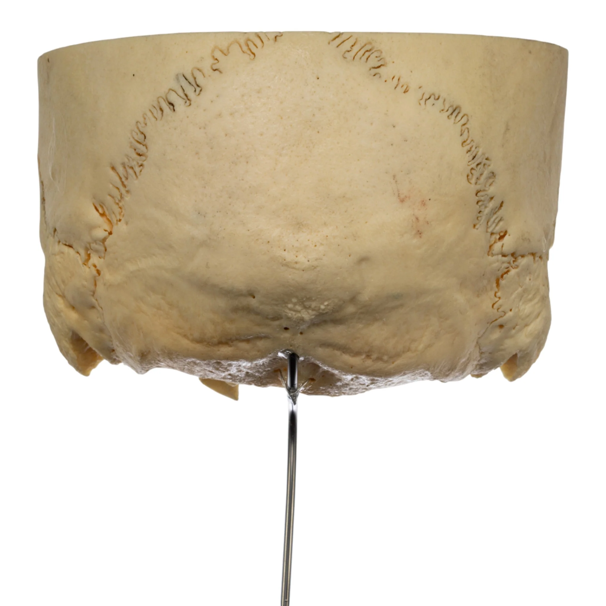 Real Human Partial Skull on Stand - Image 5