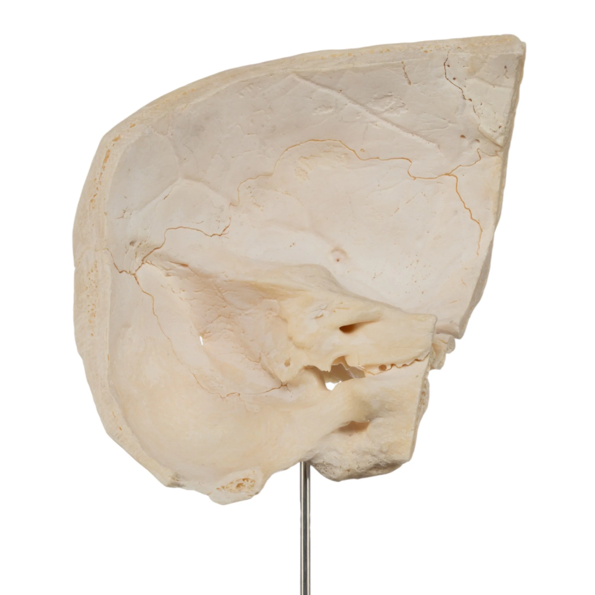 Real Human Partial Skull on Stand - Image 2