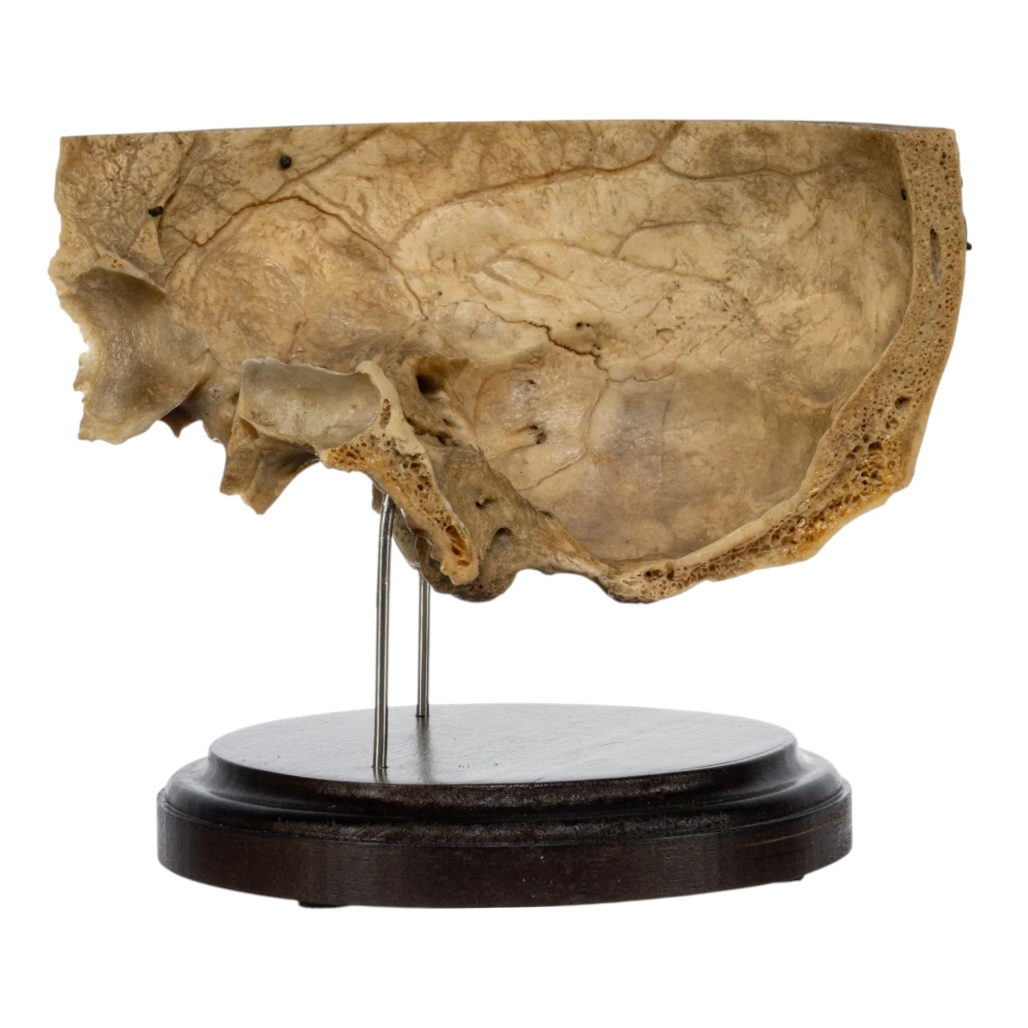Real Human Partial Skull on Stand - Image 2