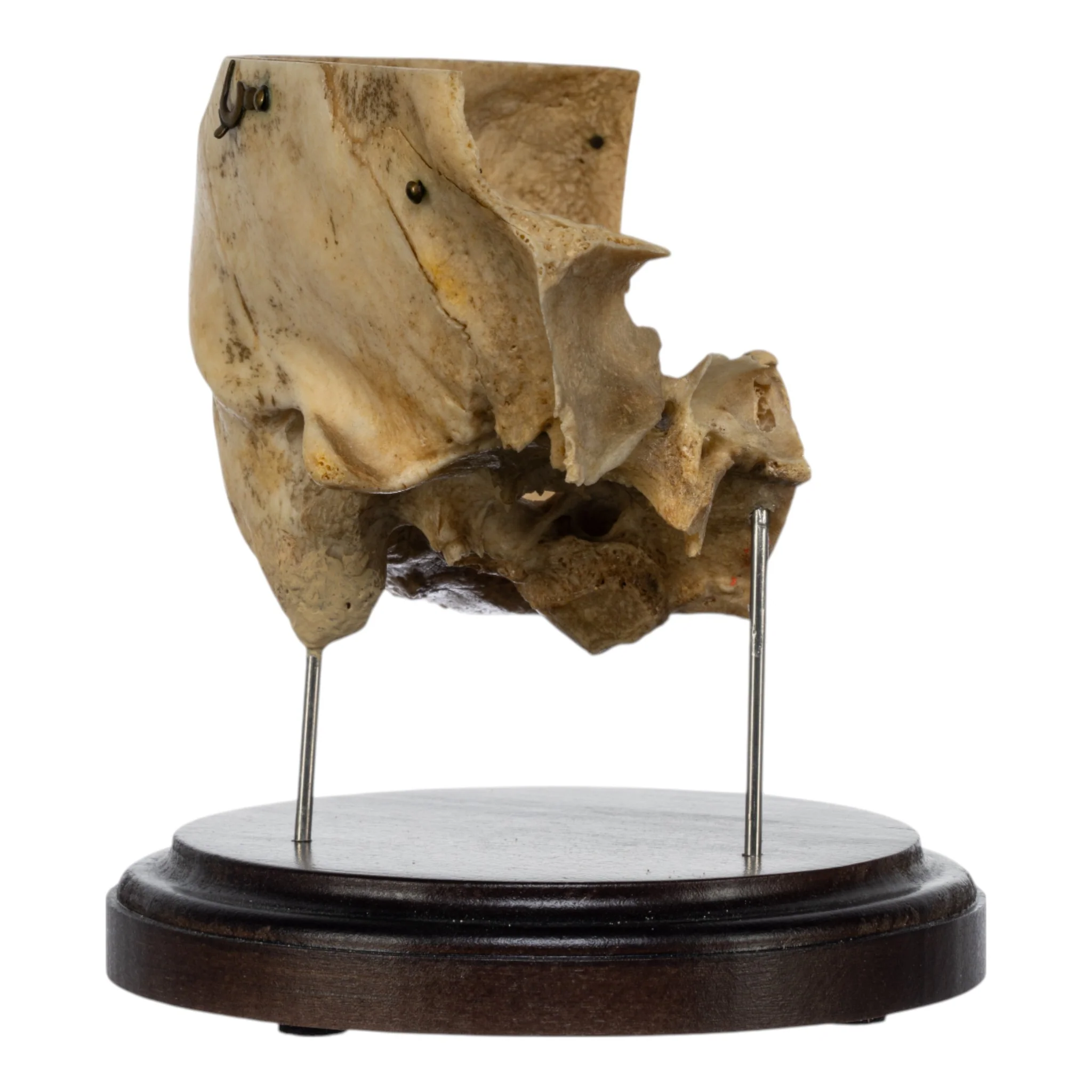 Real Human Partial Skull on Stand - Image 3