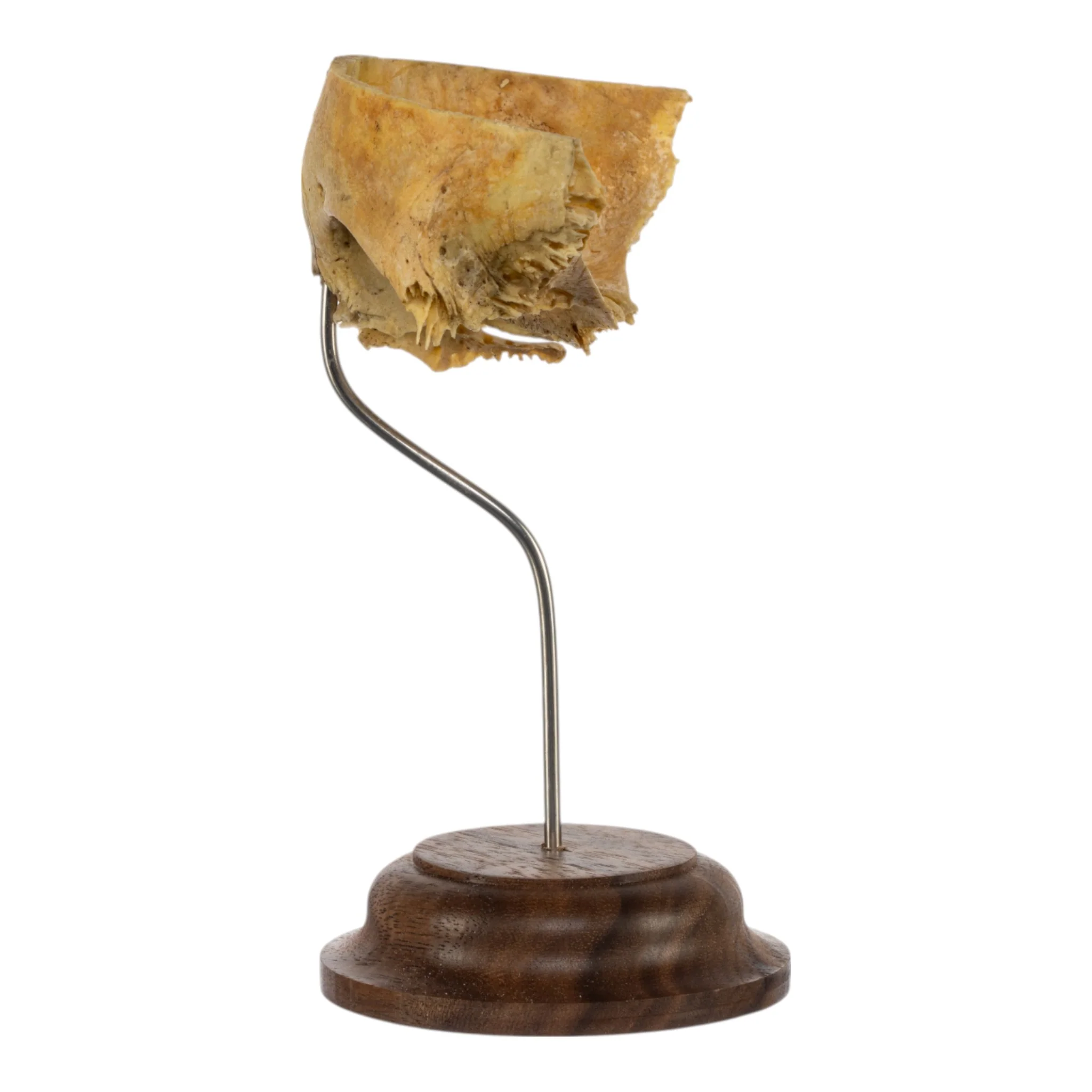 Real Human Partial Frontal Bone on Stand - Image 4