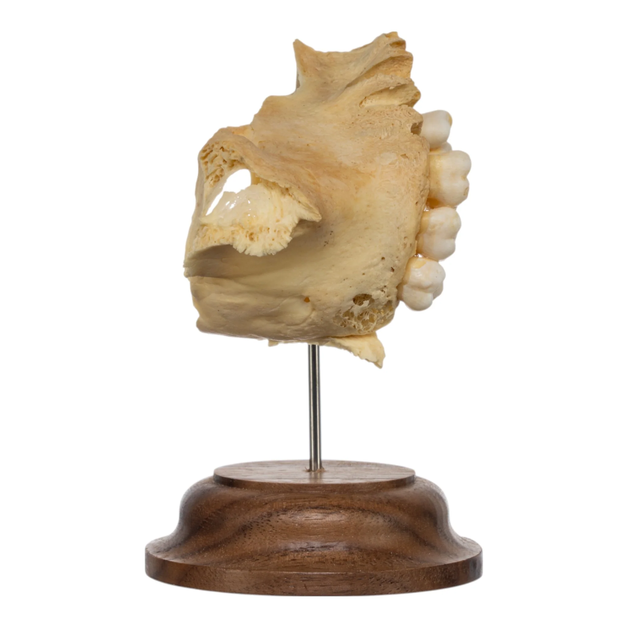 Real Human Partial Maxilla on Stand - Image 2