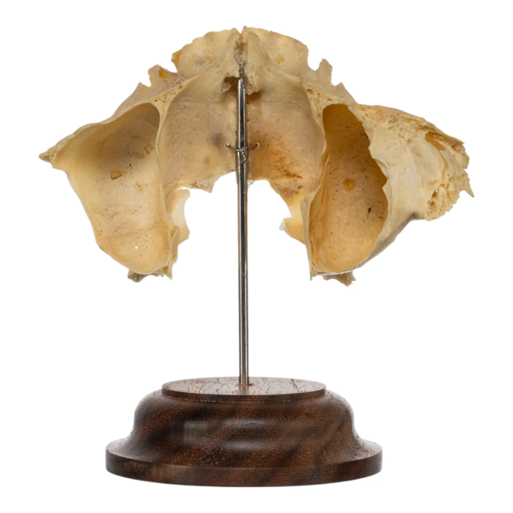 Real Human Partial Maxilla on Stand - Image 3