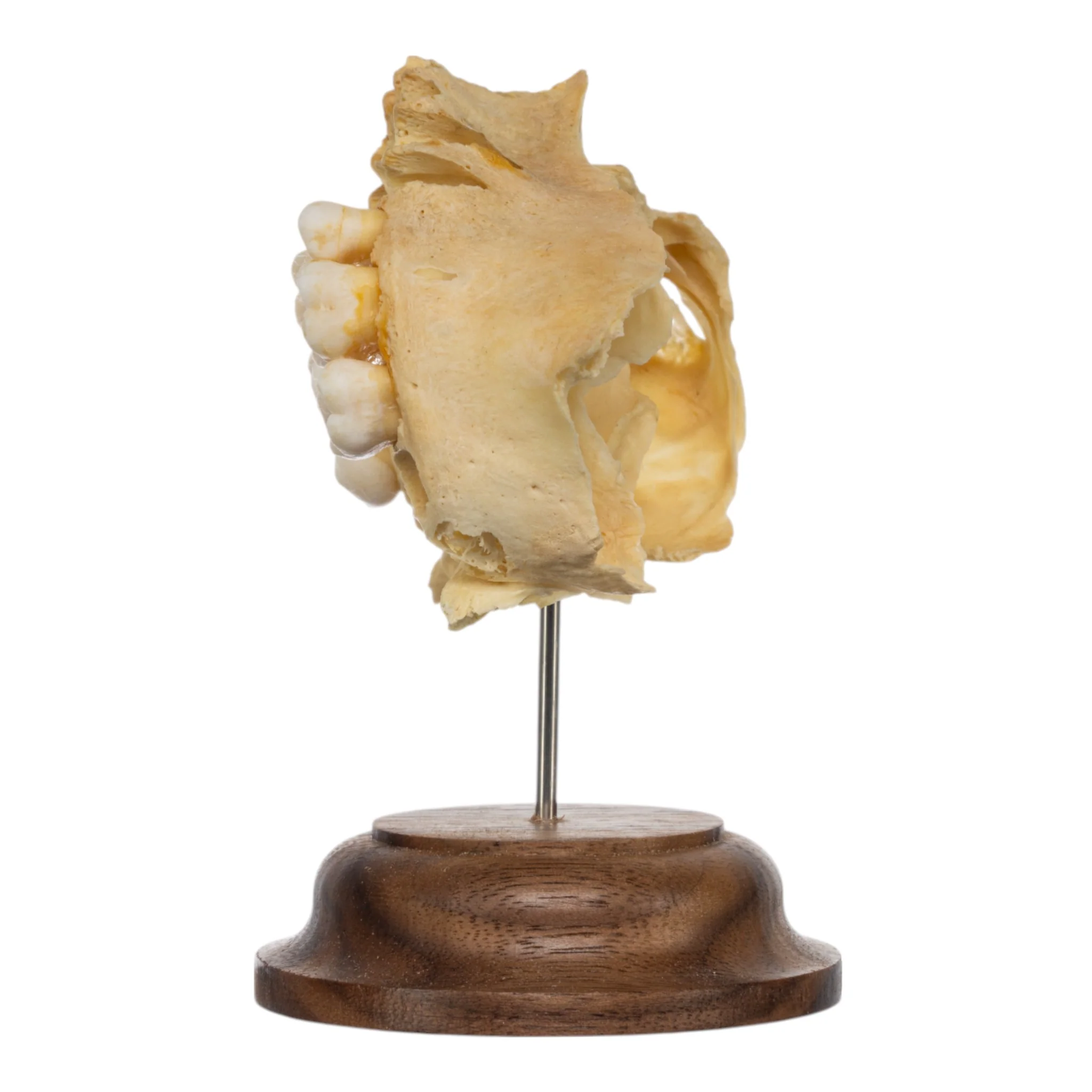 Real Human Partial Maxilla on Stand - Image 4