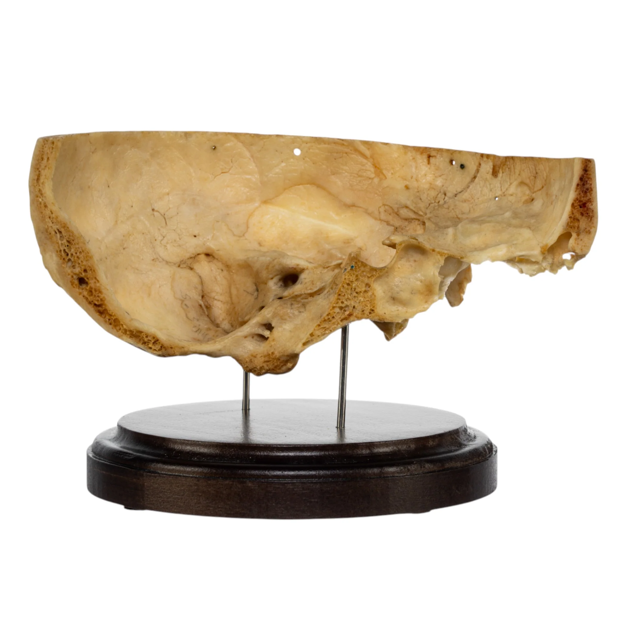 Real Human Partial Skull on Stand - Image 2