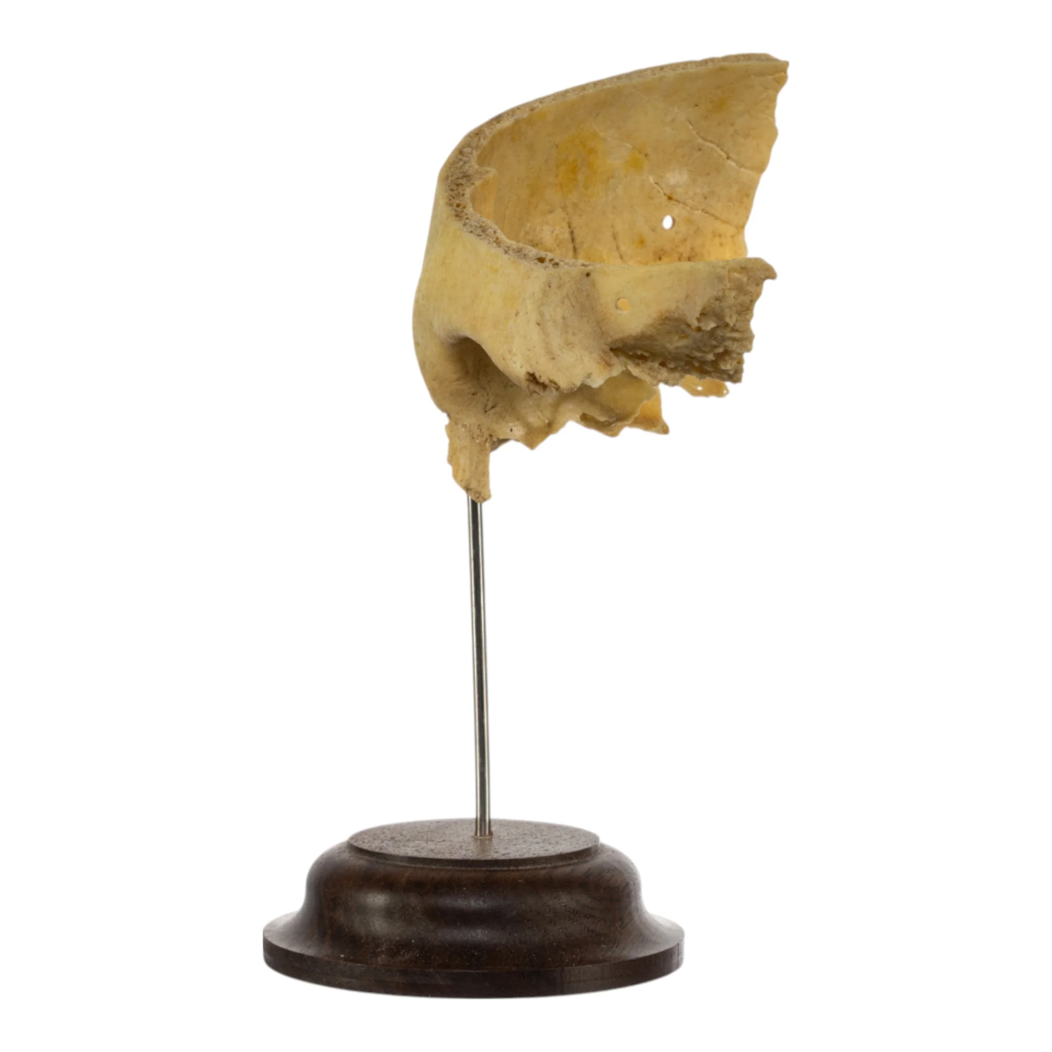 Real Human Partial Skull on Stand - Image 3