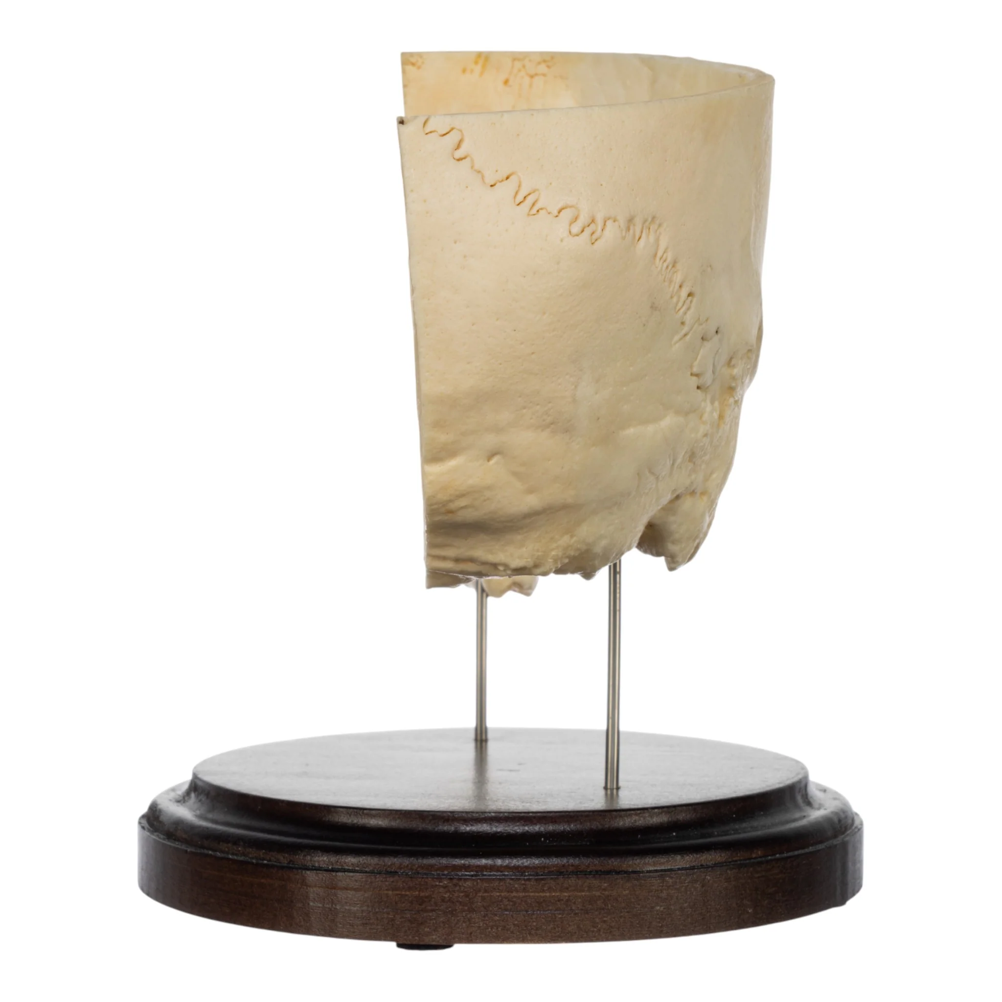 Real Human Partial Skull on Stand - Image 4
