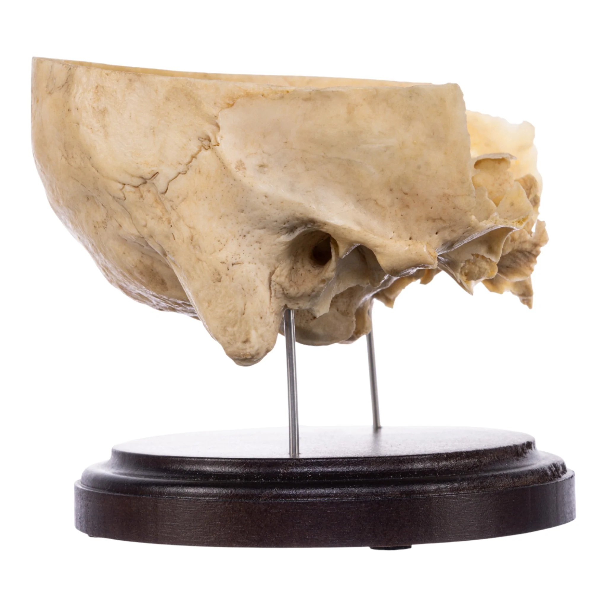 Real Human Partial Skull on Stand - Image 2