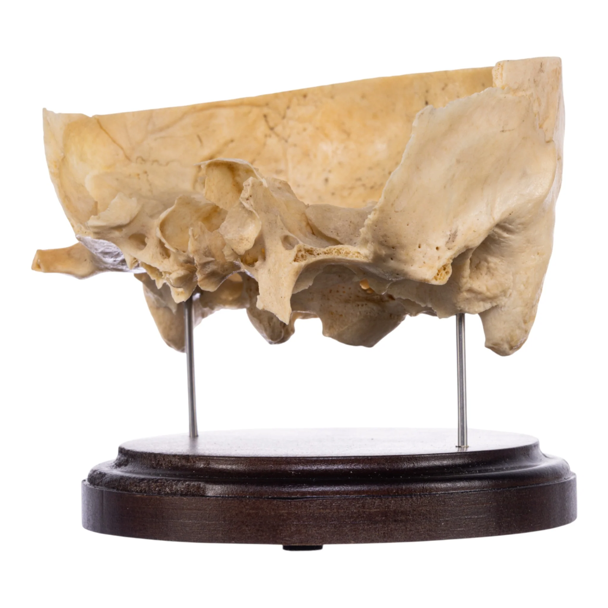 Real Human Partial Skull on Stand - Image 3