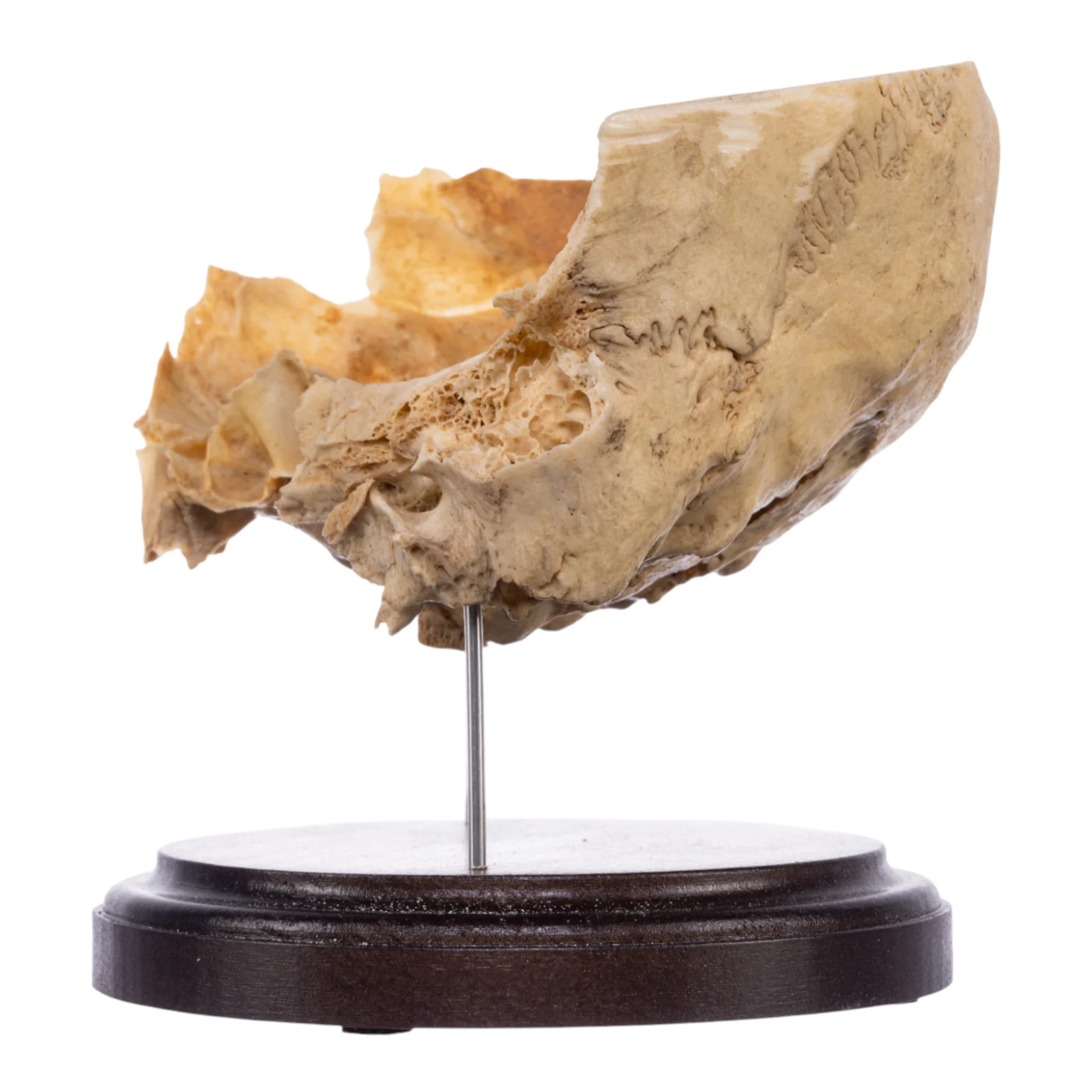 Real Human Partial Skull on Stand - Image 4