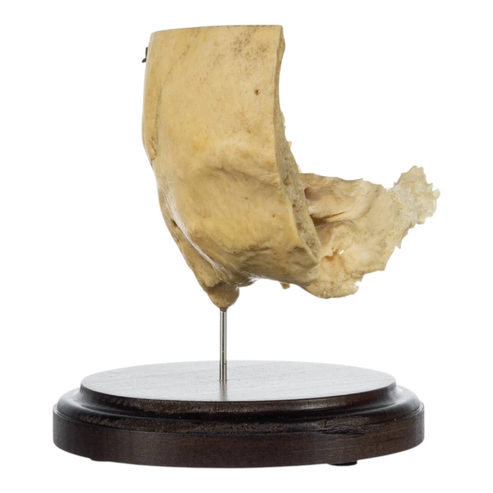 Real Human Partial Skull on Stand - Image 2