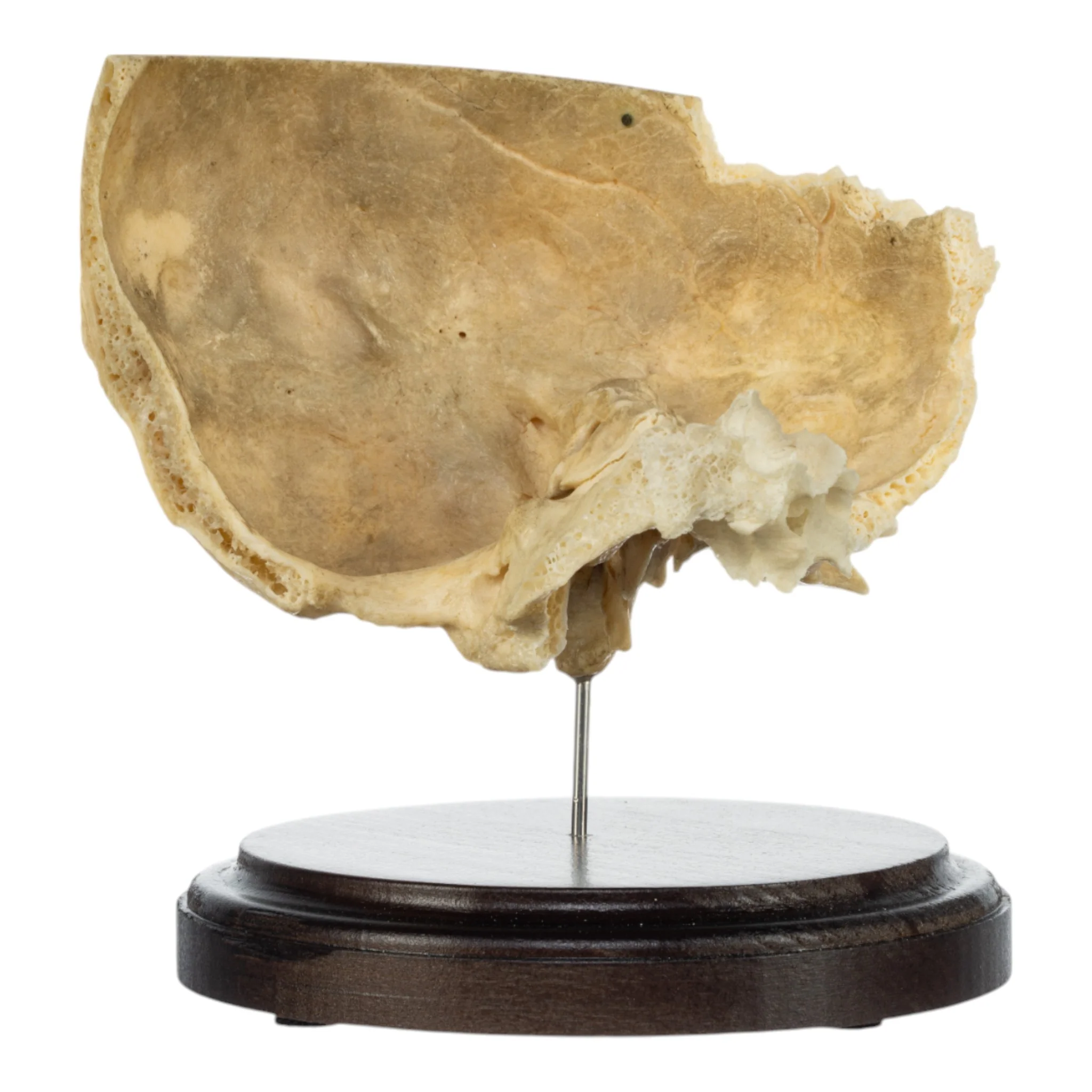 Real Human Partial Skull on Stand - Image 3