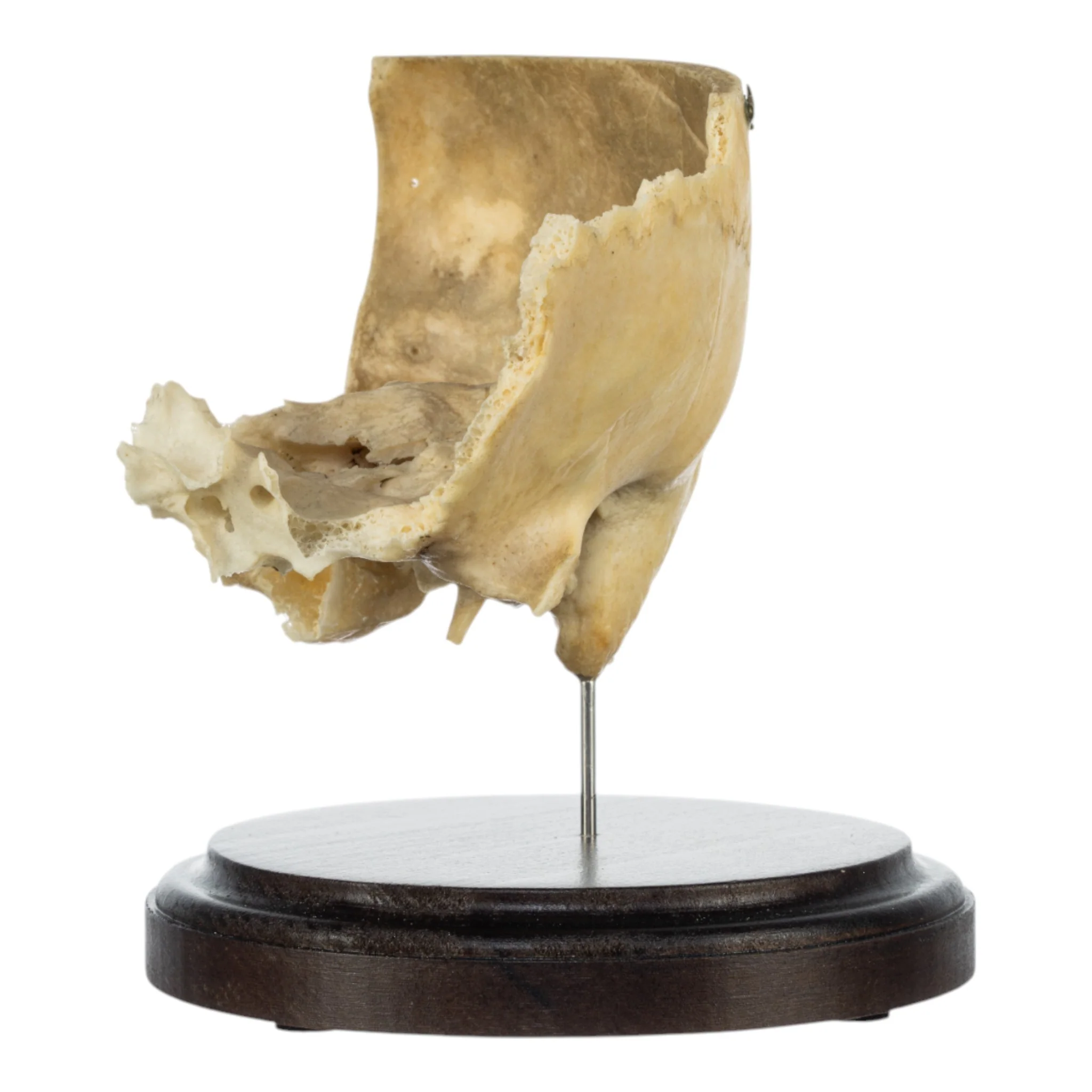 Real Human Partial Skull on Stand - Image 4
