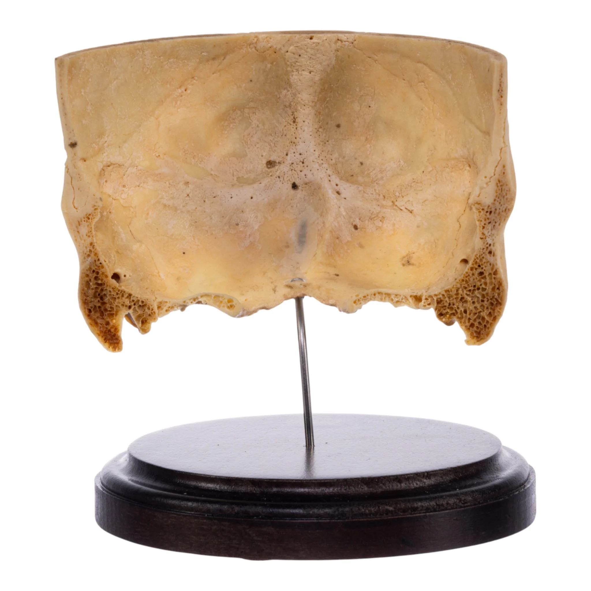 Real Human Partial Skull on Stand - Image 3