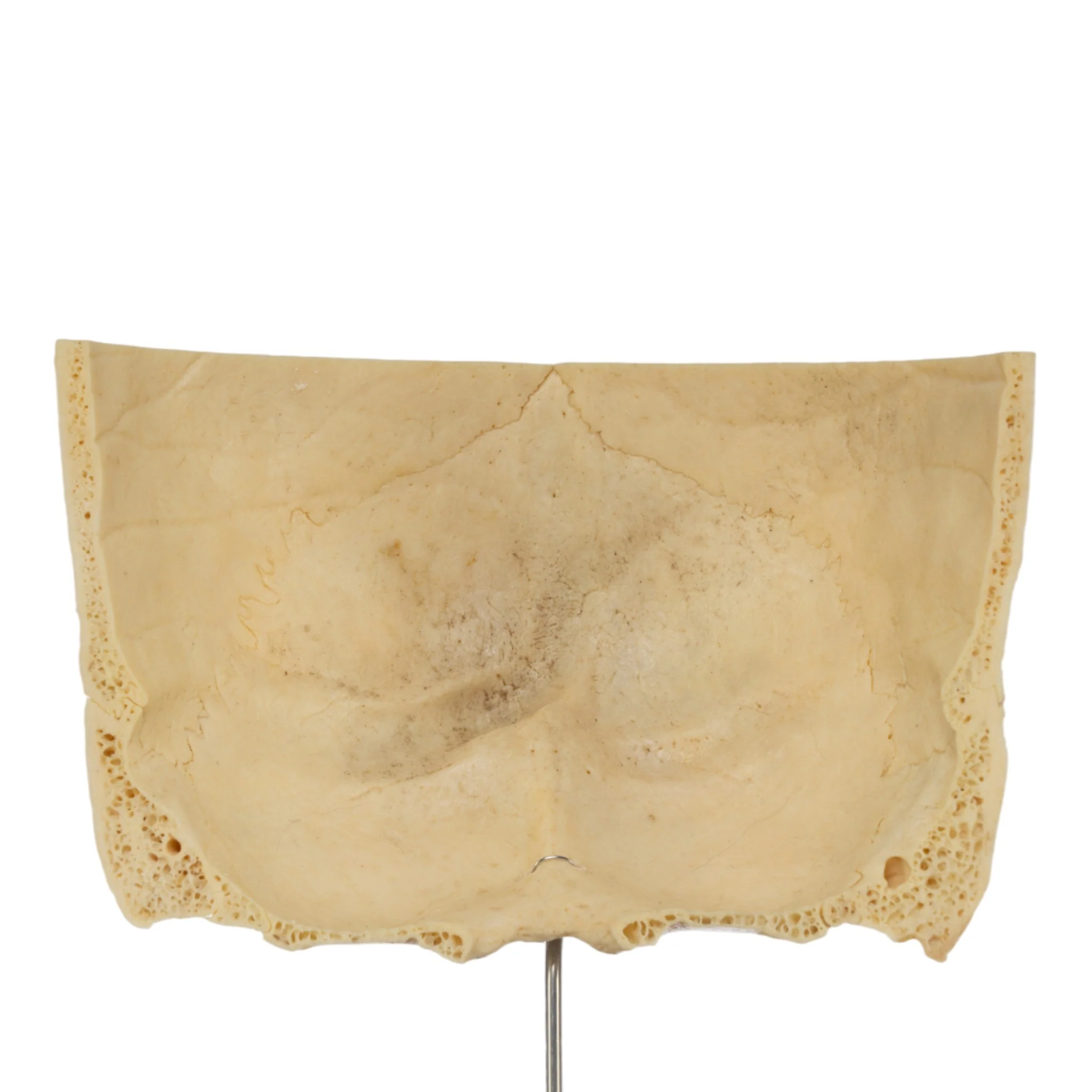 Real Human Partial Skull on Stand - Image 2