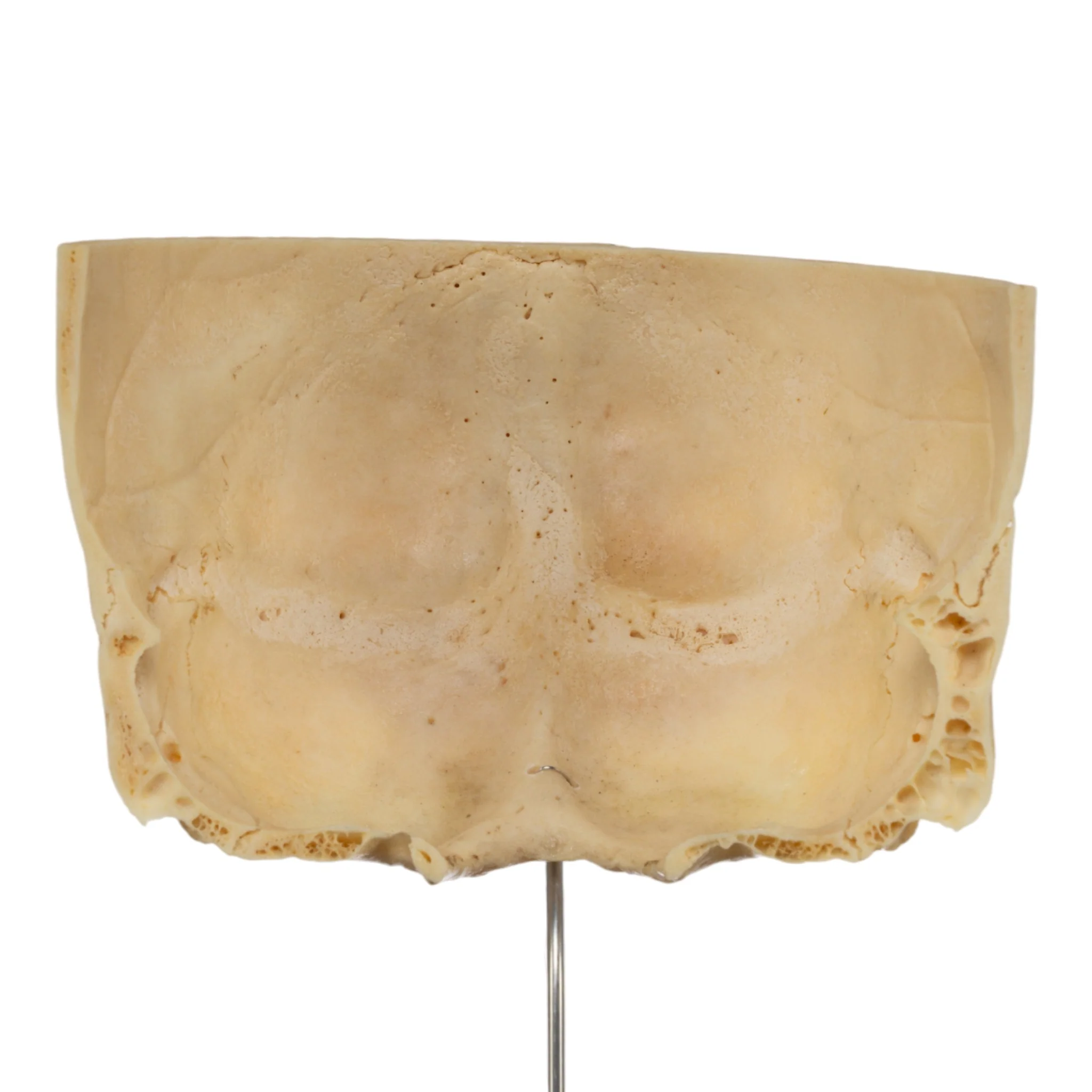 Real Human Partial Skull on Stand - Image 2